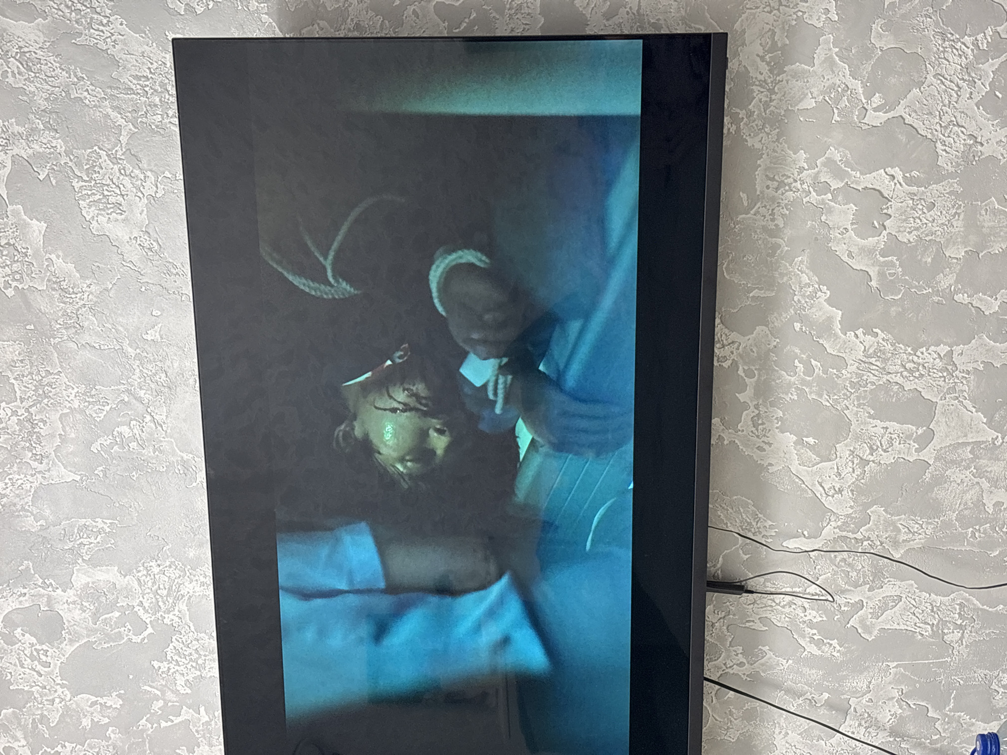 The image displays a flat-screen television mounted on a light gray wall with a heavily textured, stucco-like finish. Two dark cables hang vertically below the television, with one exhibiting a loose coil. A partial blue object is visible in the bottom left corner.
The television screen presents a scene primarily illuminated by dim, blue-teal light. Two individuals are depicted. On the left, the upper torso and arm of a person wearing a light blue top are visible, positioned as if leaning over or attending to another individual. The second individual is lying prone, facing upward, exhibiting dark, matted hair and visible bloodstains on the forehead and across the facial area. This person is clad in dark clothing, and a white, braided bracelet or cuff adorns their left wrist. A third arm, similarly featuring a white bracelet or cuff, is present on the right side of the screen. Beneath the supine individual, a light-colored, possibly white, basin or tray is visible. The scene on the screen suggests an incident involving injury. The location is an unspecified room in the city of Unknown, Unknown.