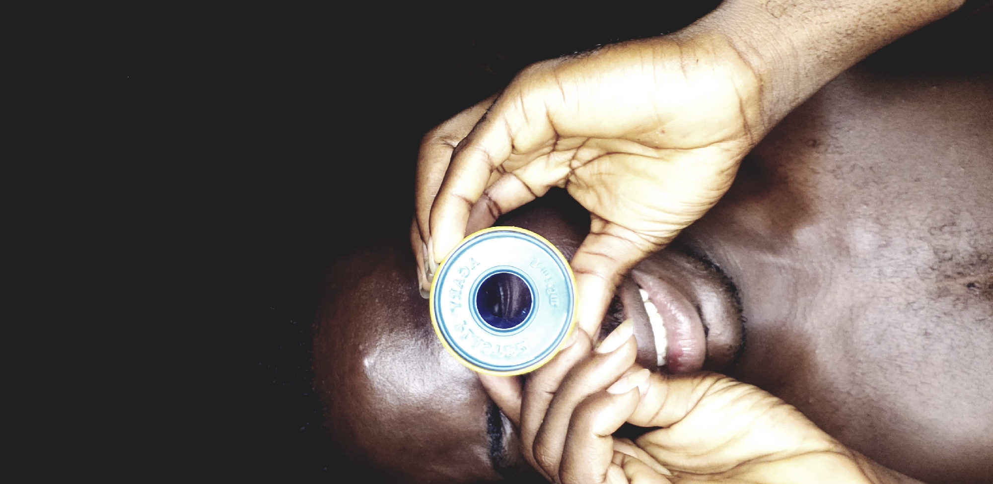 An adult person is lying on their back, facing upward. The person is dark-skinned, with closed eyes, and an open mouth revealing their teeth. They are holding a roll of blue and white "S.T.R.A.L.S." Teflon tape up to one eye with both hands. The background is dark and undifferentiated. The location is Narayi, Nigeria.