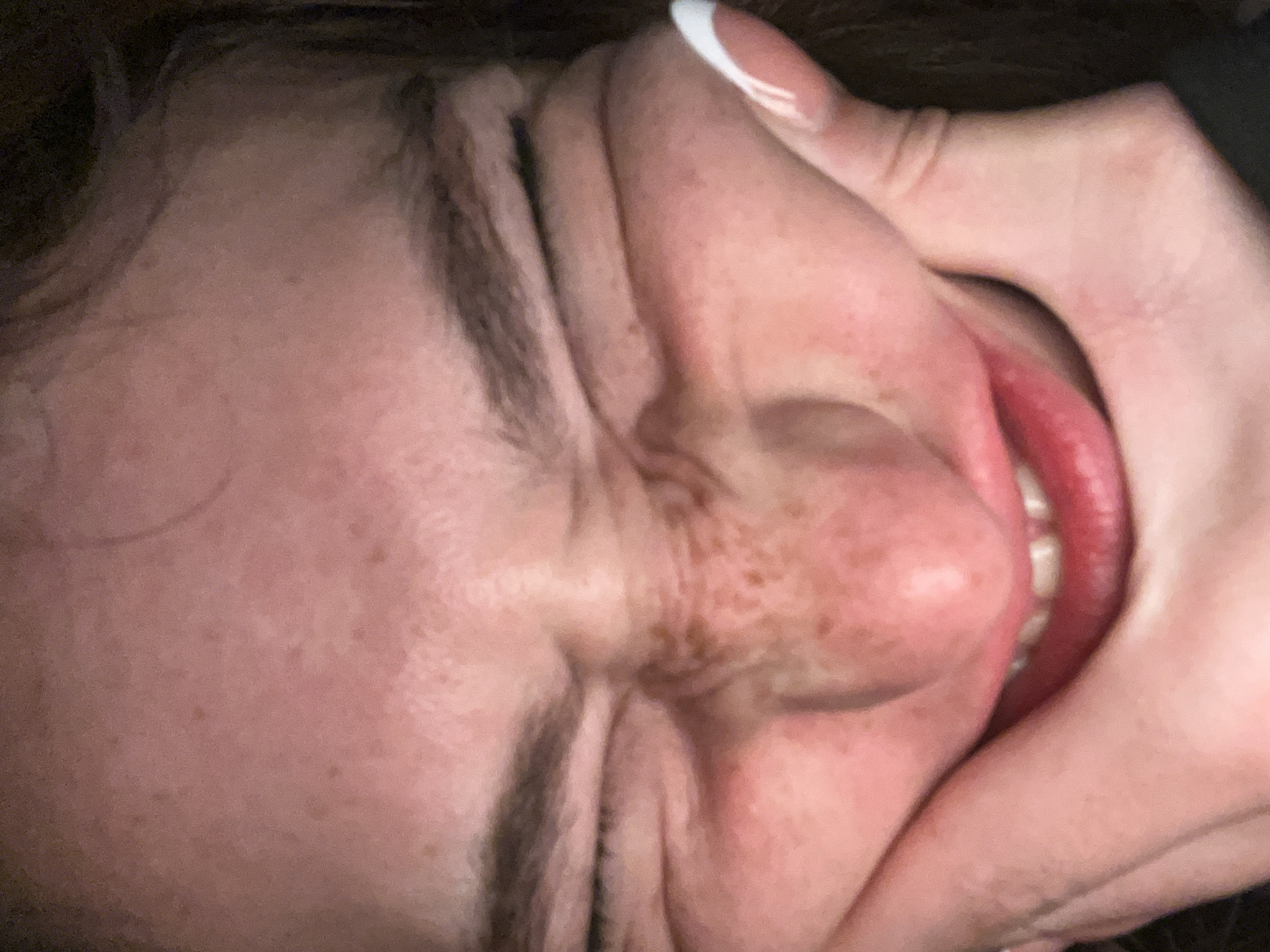 The image depicts a close-up of a person's face being contorted by a hand. The person's eyes are closed, and the skin is pink with visible freckles. The hand is also pink and partially obscures the mouth. The lips are red, and some teeth are visible. The location is unknown and there is no information to indicate that this image was taken in the city of San Bernardino Tlaxcalancingo, Mexico.