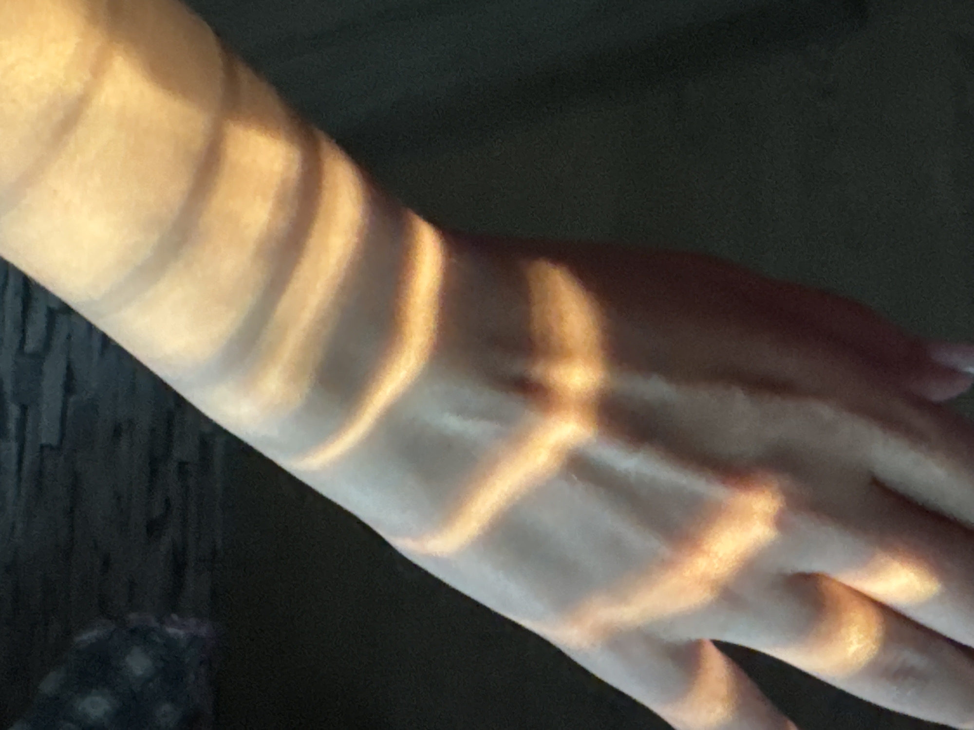The image shows a human arm and hand with parallel bars of light and shadow projected across them. The skin is light-toned. The background is dark and indistinct, suggesting a dim interior setting. No city or location is discernible from the image.