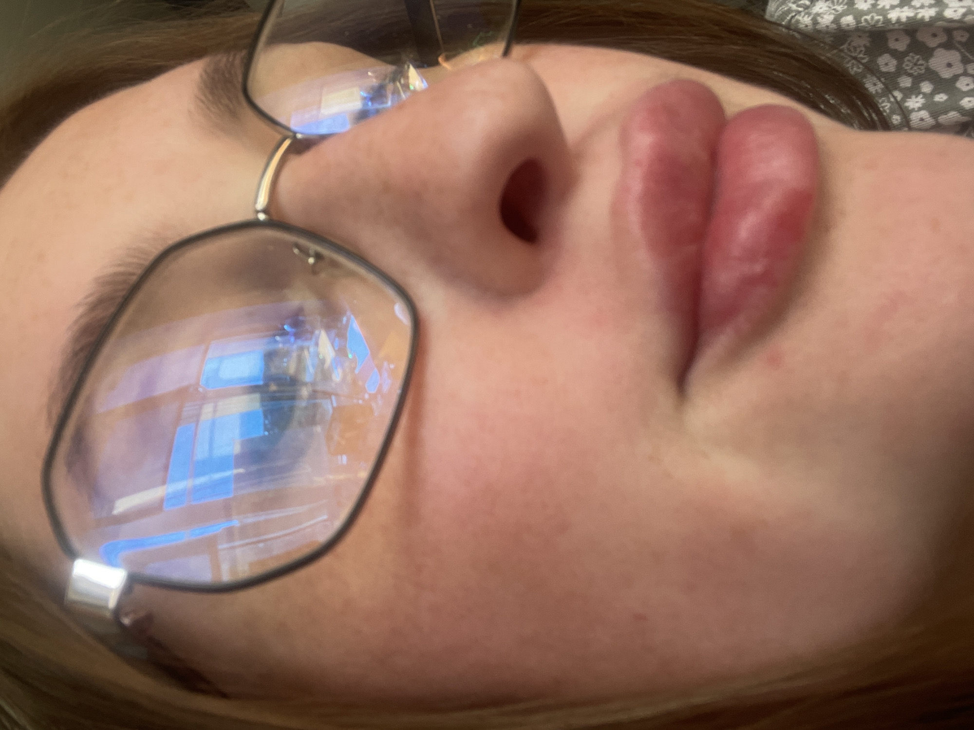The image is a close-up, low-angle shot of a person's face, focusing on their mouth, nose, and glasses. The subject is wearing round, dark-rimmed glasses that reflect a room with windows and furniture. The person's lips are slightly parted and appear to be full and possibly glossed. Their skin is fair with some redness and subtle blemishes. The background is out of focus, showing a hint of a patterned garment on the right side. The image does not provide any information or context related to the city of Сырково, Russia.