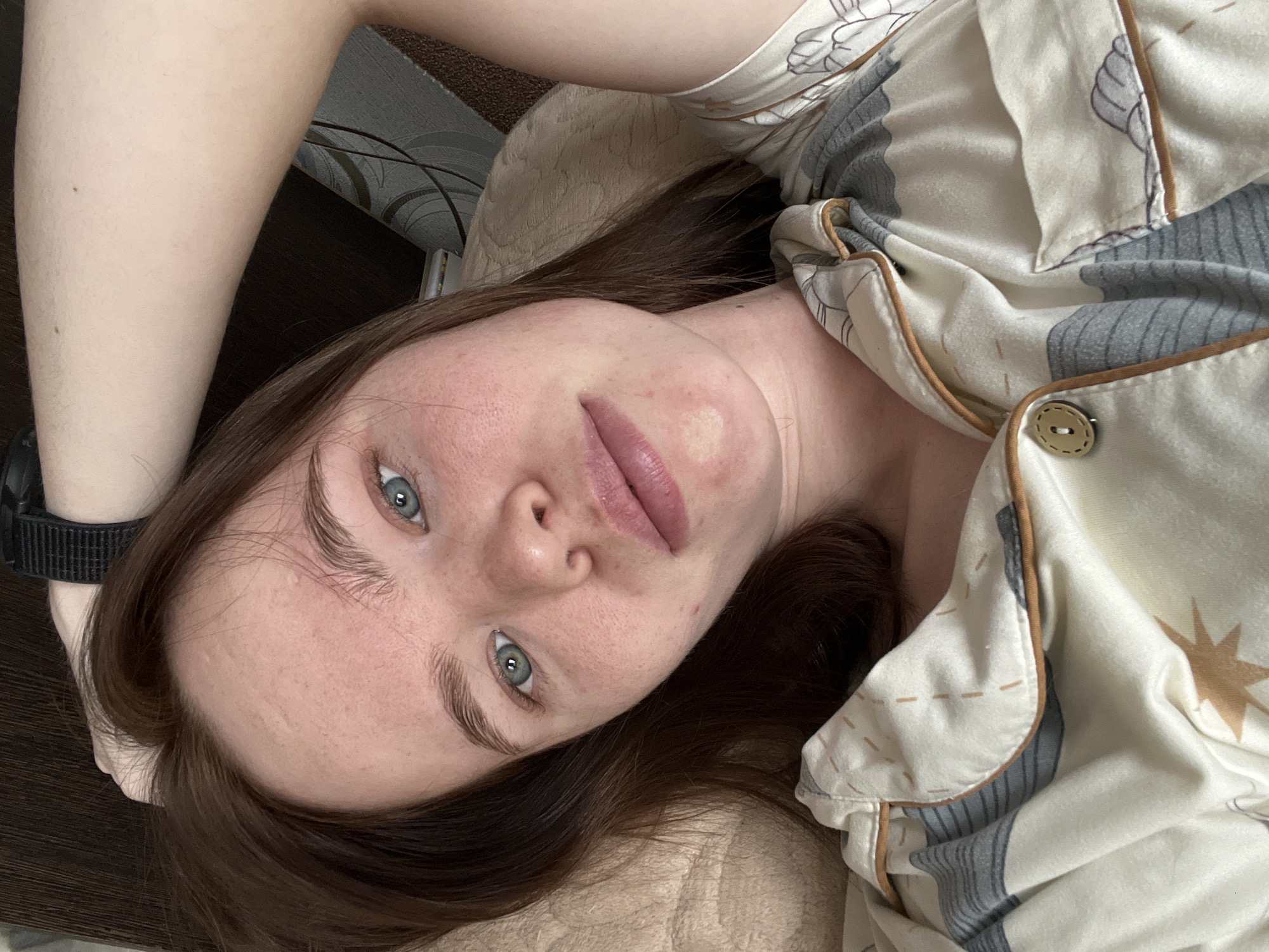 A young woman with light skin, brown hair, and striking blue-grey eyes is depicted in a close-up, high-angle shot, lying down indoors. She looks directly at the camera with a neutral to slightly contemplative expression. She is wearing light-colored pajamas adorned with a pattern of abstract grey shapes, light brown accents, and a distinct star-like motif, edged with brown piping and featuring a visible button.
Her left arm is raised, revealing a black digital watch on her wrist. A soft, light-colored pillow or bedding supports her head. Notable details on her face include a lighter, somewhat discolored patch on her left cheek/jawline, and her lips are slightly parted. Her skin shows natural variations such as faint lines on her forehead and small freckles. The overall lighting suggests it is daytime. The setting appears to be a private, comfortable space, consistent with a bedroom. No text is visible in the image.