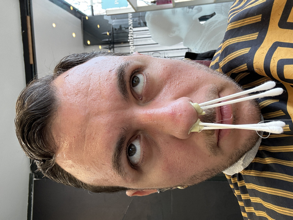 A male individual, mid-face to upper chest, is depicted in a close-up, front-facing shot inside what appears to be a barber shop or salon. He has short, dark, slicked-back hair, with visible short hair clippings on his forehead and temples, indicative of a recent haircut. He wears a black and yellow striped barber's cape. His eyes are directed upwards. Four white cotton swabs are inserted into his nostrils, two per nostril, coated at their base with a pale yellow, viscous substance consistent with hot wax for hair removal, with some substance dripping down the swabs. His left ear displays a gold hoop earring and a silver-colored bar earring. The background, largely out of focus, shows reflections in a window or glass partition, including the reversed text "www.cuttup" on the right, and a faint, ethereal reflection of a person in profile. The scene takes place in the City of London, United Kingdom.