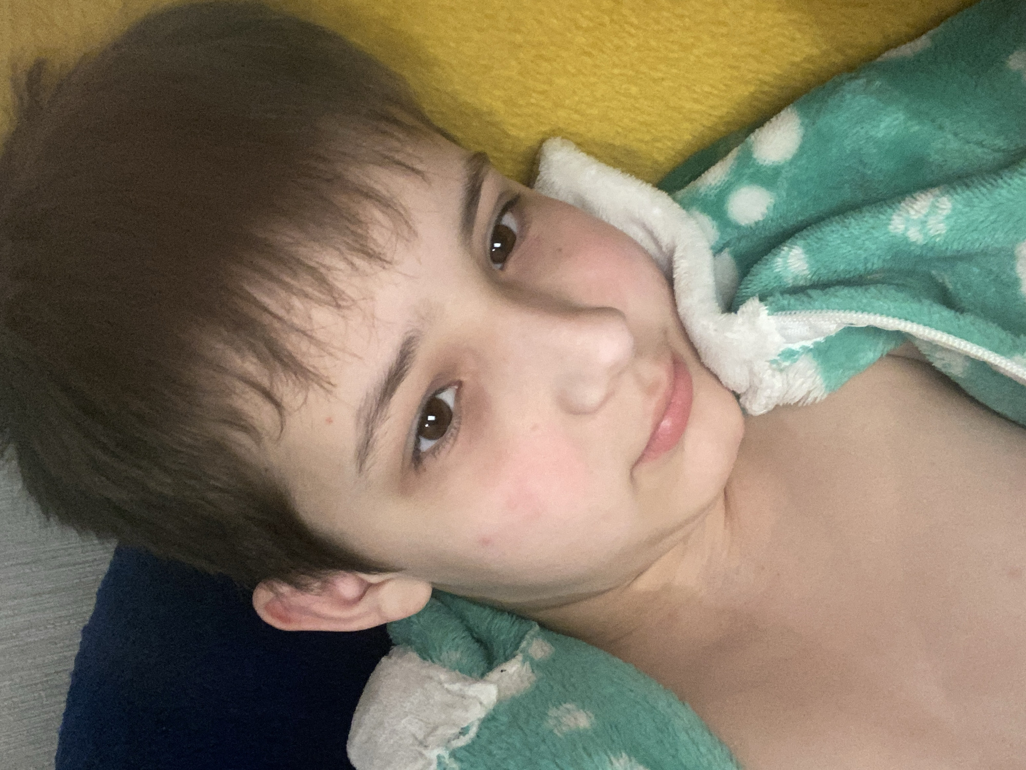 A young person lies on a blue surface with a yellow blanket behind their head. They are wearing a green and white hooded garment. The child is looking at the camera. No location information is provided in the image.