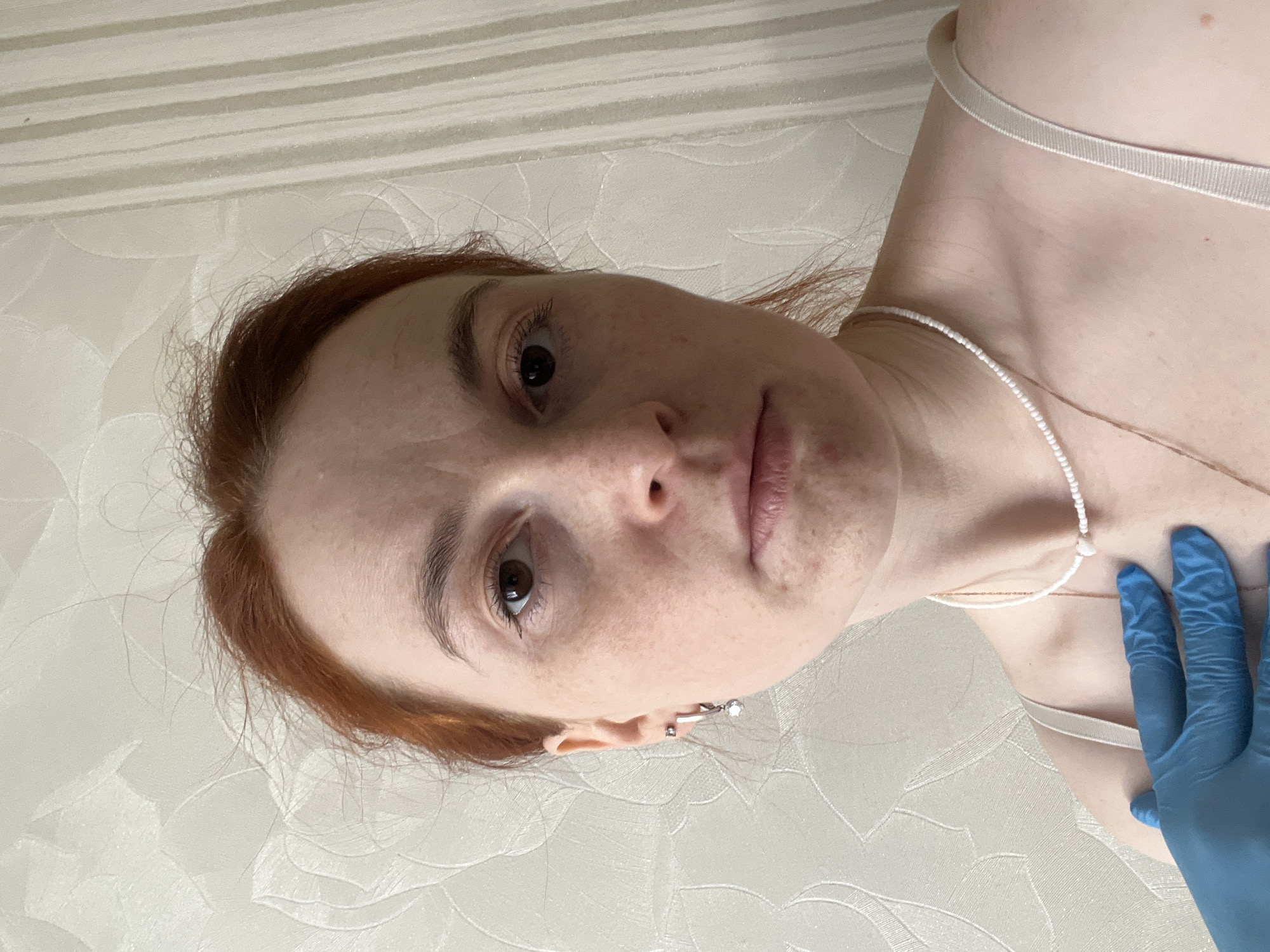 A close-up, angled portrait shot depicts a fair-skinned woman with red hair, freckles, and brown eyes. She is wearing a delicate white beaded necklace and a light-colored garment with a thin strap. A hand covered with a blue nitrile glove touches the woman's upper chest/shoulder area. The background is a patterned white surface, possibly a wall. The setting appears to be indoors. There is no information to confirm the location in the city of Chaikovsky, Russia.