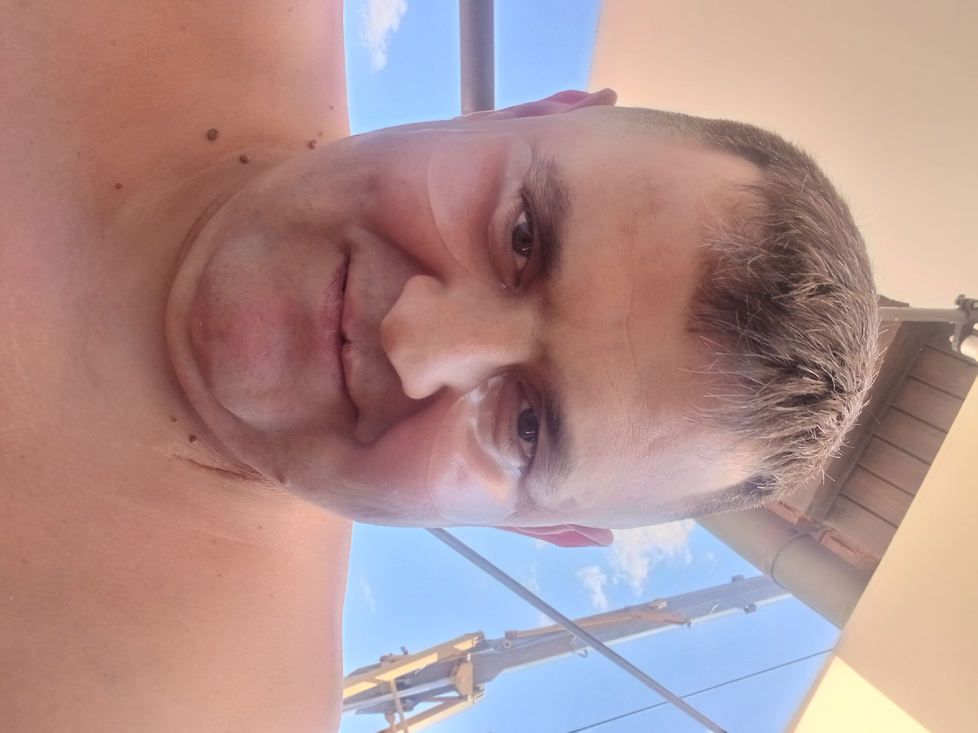 A close-up, selfie-style photograph shows a person's face and upper torso against a bright blue sky with scattered white clouds. The person has short, styled brown hair, and appears to be wearing eye patches under their eyes. The background shows what appears to be part of a structure, possibly an outdoor canopy or roof, with a yellow industrial-looking structure to the right. The person has several small moles visible on their neck and upper chest. The lighting suggests it is daytime and outdoors, possibly at a recreational facility. There is no specific visual information to indicate the location of Pfarrkirchen, Germany.