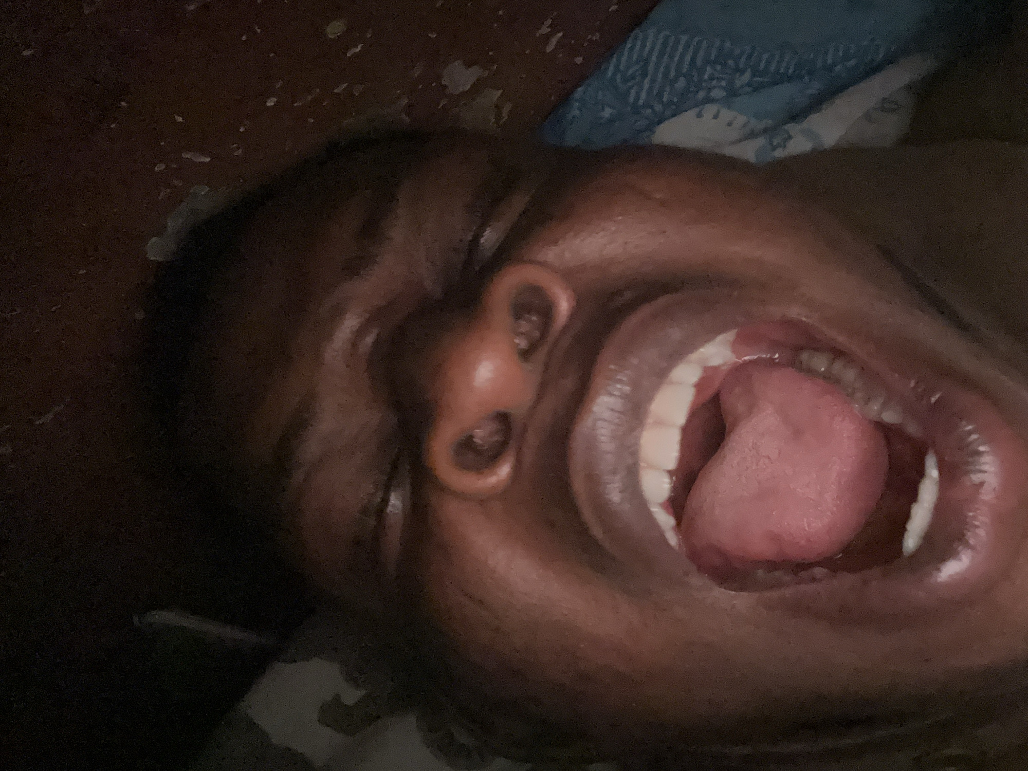 A close-up, dimly lit image shows a person with dark skin lying down with their mouth wide open, revealing their tongue and teeth. The person's eyes are closed. The background is dark, with some blurred bedding visible.