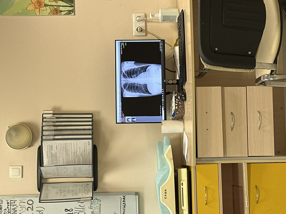 The image shows a doctor's office. On the wall is a chest x-ray displayed on a monitor. Below the monitor is a dispenser for sanitary wipes. To the left are stacked medical files on a wall-mounted rack. Below the files is a whiteboard with handwritten notes in what appears to be Cyrillic script. To the right, there's a partially visible office chair and cabinets with light-colored wooden doors and yellow drawers.