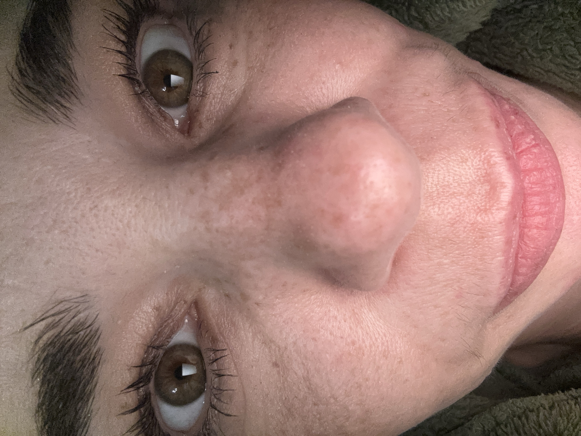 A close-up photograph shows a person's face at an upward angle. The eyes are brown with visible eyelashes. The eyebrows are thick and dark. The nose is prominent and slightly off-center. The lips are a pale pink color. Freckles are visible on the skin around the eyes and nose. The background is blurry and appears to be a dark green color. There is no indication of Vsevolozhsk, Russia in this image.