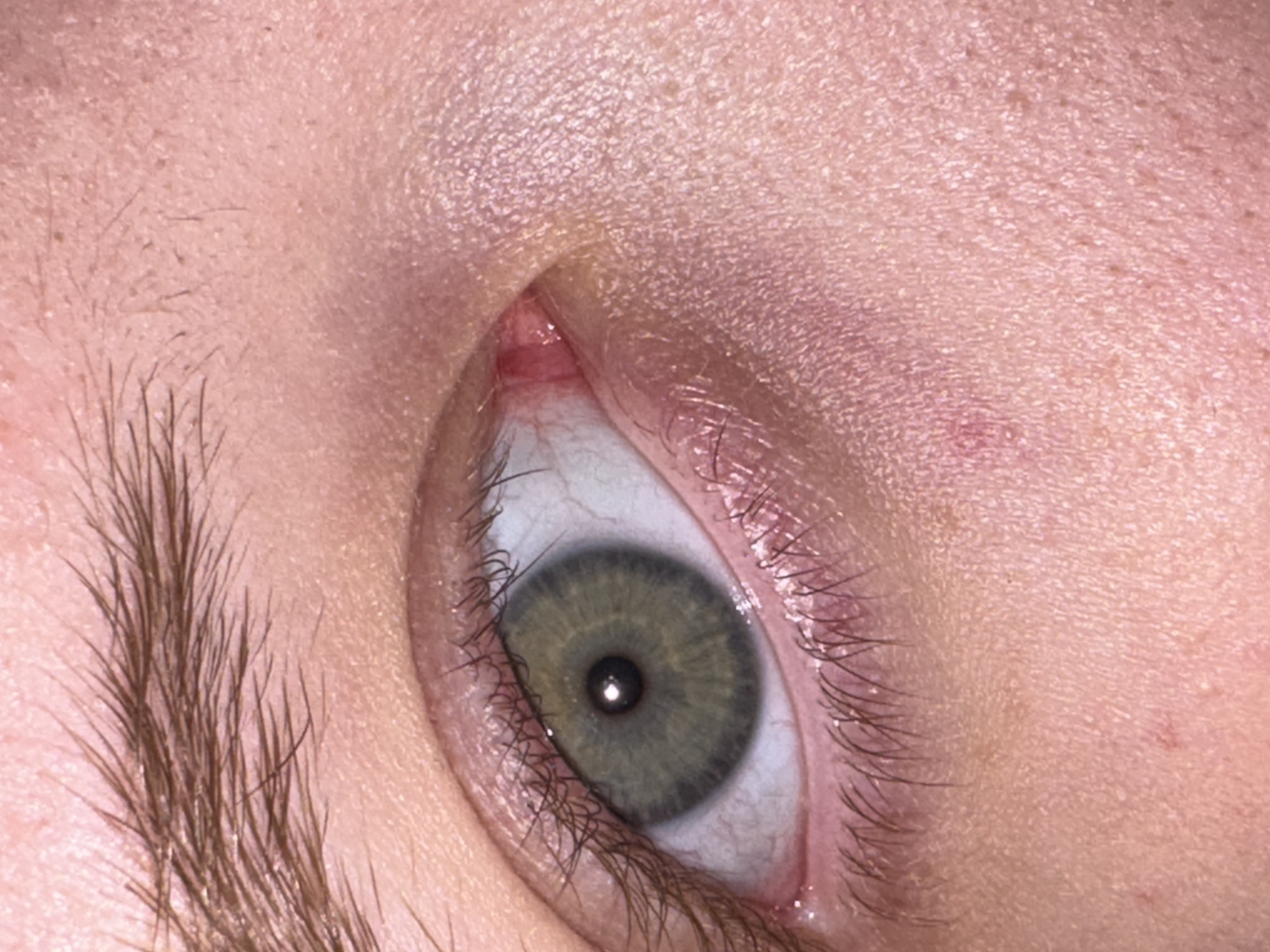 A close-up, high-angle macro photograph captures a human eye. The eye is open, revealing a green iris with a dark pupil at its center. The sclera, the white part of the eye, is visible and appears slightly bloodshot. Eyelashes frame the top and bottom of the eye, and the eyebrow is visible in the upper portion of the frame. The skin surrounding the eye exhibits pores and subtle texture. The lighting creates a slight reflection on the pupil. No city or location information is available for this image.