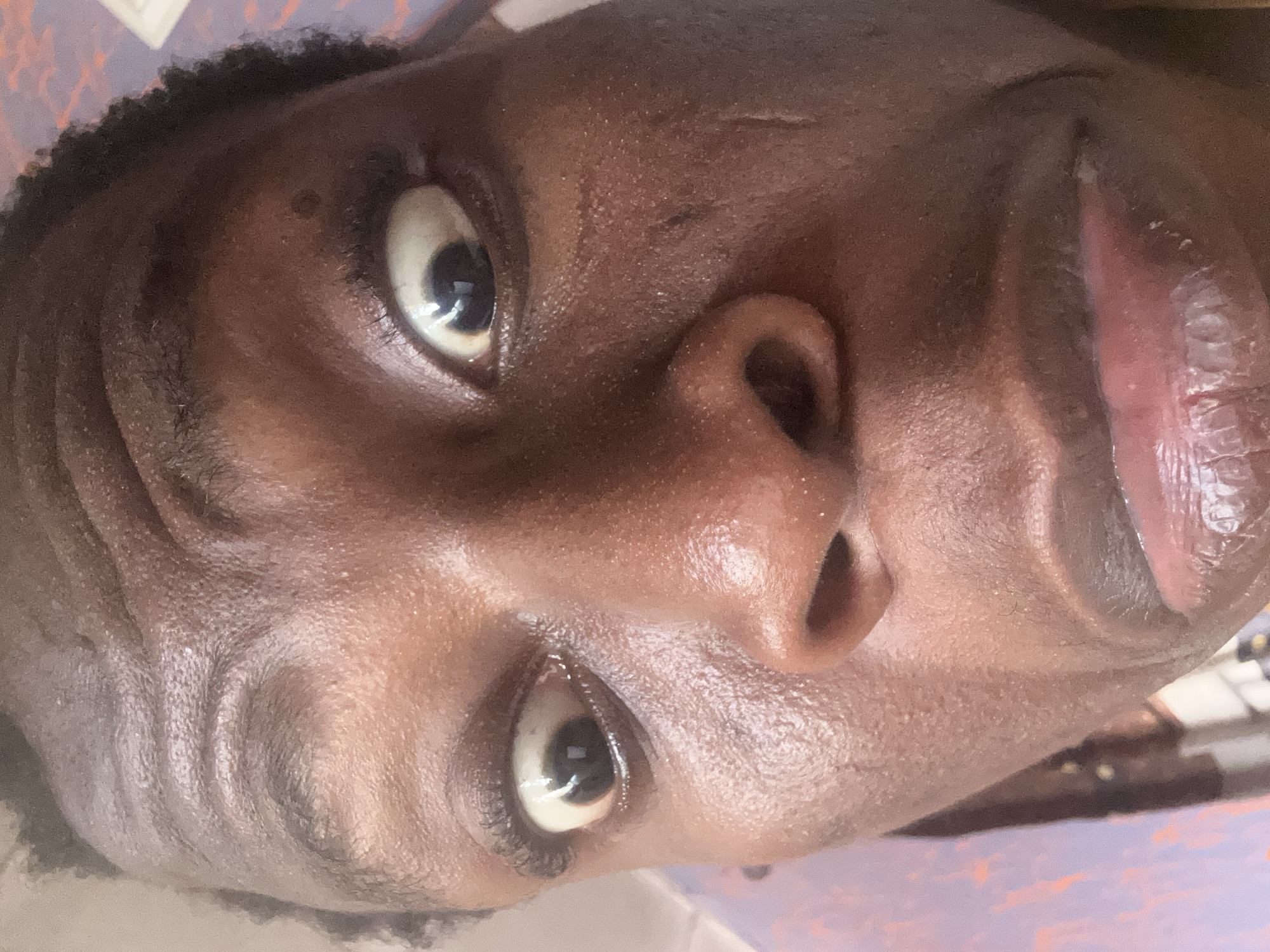 The primary image is an extremely close-up portrait of a person's face, oriented sideways (rotated 90 degrees clockwise). The subject is an individual with dark skin, whose face fills most of the frame.
The person's eyes are wide open, with prominent white scleras, dark irises, and pupils reflecting light. Moisture or tears are visible in the inner corner of the eye on the left (as viewed in the rotated image). The nose is central, and the full lips are slightly parted, displaying their natural reddish-pink color and textured surface. The skin has a somewhat shiny appearance, possibly due to natural oils or a product, and shows detailed texture, including pores, fine lines, and wrinkles on the forehead and around the eyes. A small, dark spot is visible on the upper forehead.
The wide-eyed expression suggests surprise, intensity, or perhaps a moment of focused attention. The background is entirely out of focus, composed of soft, indistinct shapes and muted colors, providing no specific location cues but implying an indoor or private setting. There is no visible text in the image.