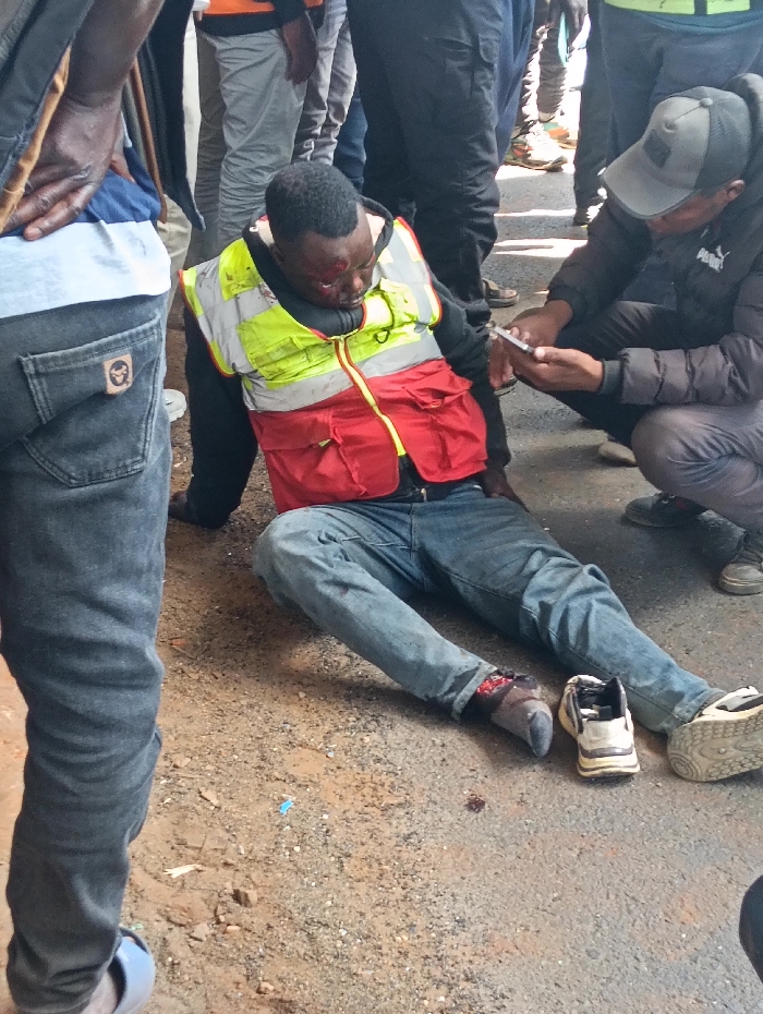 An urban outdoor scene depicts an injured adult male seated on the ground, surrounded by multiple individuals. The seated man has short dark hair and a dark complexion. He wears a black long-sleeved garment, a fluorescent yellow-green and red high-visibility vest with multiple utility pockets, and blue jeans. A dark object, possibly an earbud, is visible around his right ear. Bloodstains are visible on his face, specifically across his nose and extending to his right cheek and forehead. His right shoe, an off-white sneaker with dark accents, is off and lies on its side next to his right foot, which is covered by a dark sock stained with blood. A small, dark red bloodstain is present on the reddish-brown dirt and grey asphalt ground adjacent to his right foot. His left foot, also in a dark sock, is partially visible.
To the right of the injured man, another adult male is crouched down. He wears a grey baseball cap, a dark puffer jacket, and grey trousers. He is actively looking at and manipulating a white smartphone held in both hands. To the left, a third adult male stands, partially visible from the waist down, wearing a light blue and white striped shirt and dark jeans. A dark square patch with a light-colored emblem resembling a monkey's face is on the right rear pocket of his jeans. His left foot is clad in a light blue slider sandal.
Several other individuals are visible standing in the background, appearing to observe the scene. The ground is a mix of reddish-brown dirt and grey asphalt or concrete, with scattered small debris and litter. The setting is a public outdoor area. A specific location within Nairobi, Kenya, cannot be determined from the visual information provided.