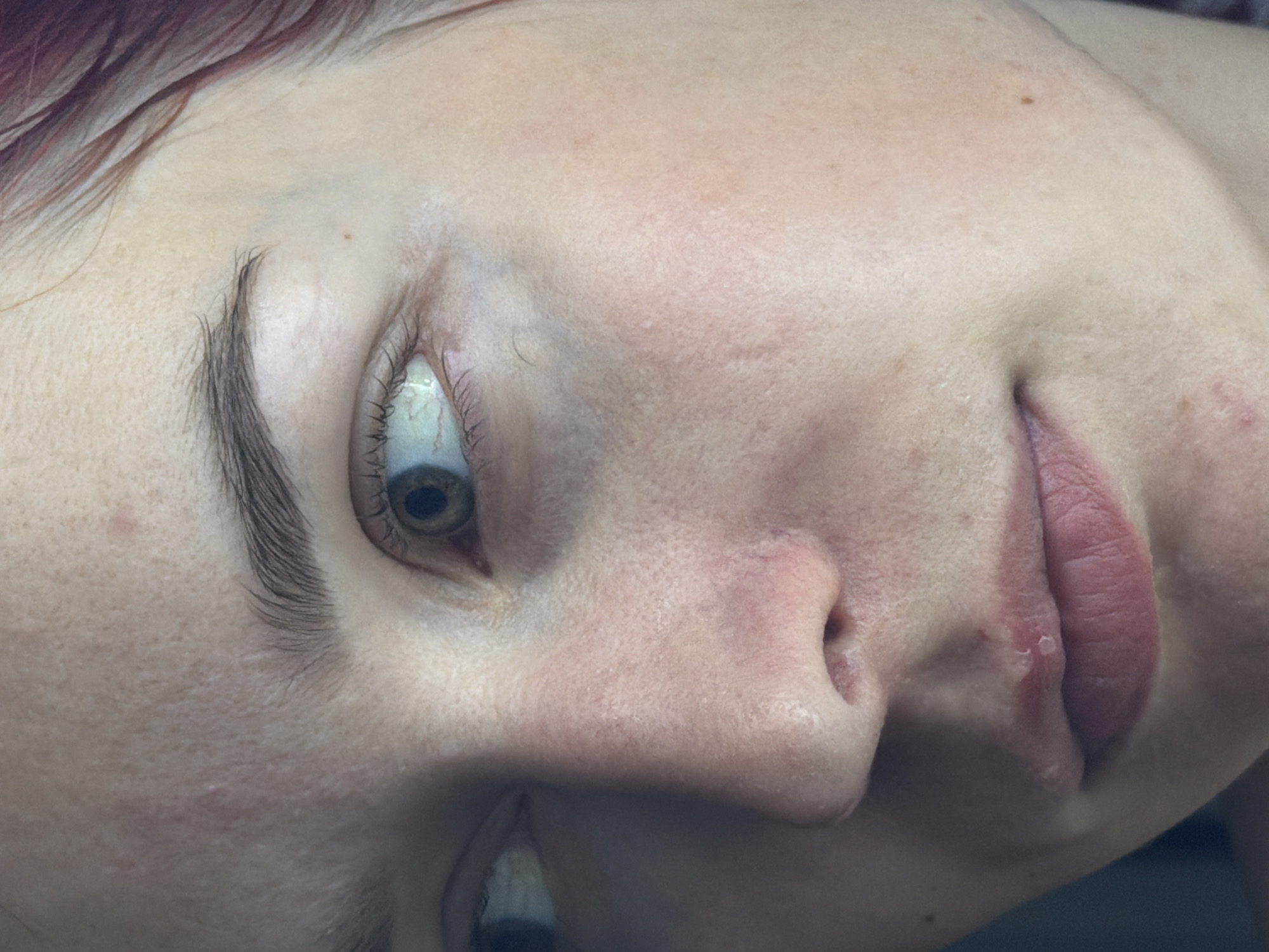 This is a close-up, headshot photograph of a young Caucasian female, likely in her late teens or early twenties. The image focuses on the right side of her face, from just below her hairline to her upper chest. Her skin appears fair with visible pores, some redness, and a few blemishes, particularly on her forehead and cheek. There are also small, dry patches on her upper lip. Her right eye is open and looking to the left, revealing a green iris and visible blood vessels in the sclera. Her left eye is partially visible, also looking to the left. Her eyebrows are dark and well-defined, and she has some reddish-brown hair visible at the top right of the frame. The lighting is soft and appears to be coming from the left, casting subtle shadows on her face. The background is dark and out of focus. The overall impression is a candid, unedited portrait highlighting the natural texture and features of the subject's skin. The location in Chaikovsky, Russia, is not visually indicated in the image itself.