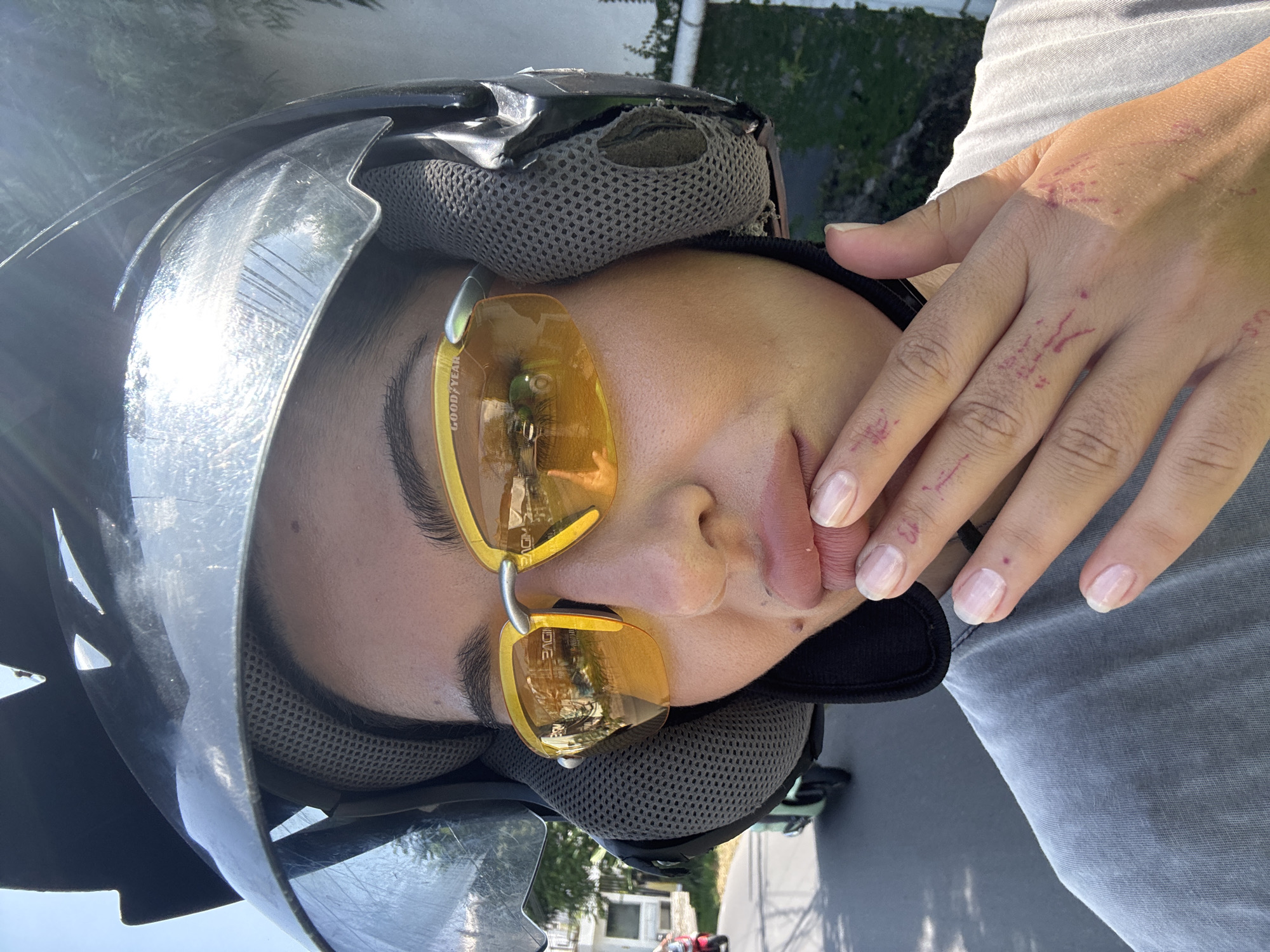 An overhead shot captures a person, likely female, wearing a black motorcycle helmet and yellow-tinted sunglasses outdoors in bright daylight. The subject's face is partially obscured by the sunglasses and her right hand, which is raised towards her chin/mouth.
The black helmet appears worn, with numerous scratches and scuffs visible on its shiny surface, particularly on the front and top. The inner mesh padding of the helmet is also visible and shows signs of wear, including a tear in one area. The yellow-tinted sunglasses have "GOODYEAR" branding visible on the arm. Reflections in the lenses show a bright outdoor scene with trees and potentially buildings.
The person is wearing a light grey top and light-colored pants, possibly denim. Her right hand, which has light-colored or unpolished fingernails, displays several reddish marks or scratches across the knuckles and back of the hand. The background shows lush green foliage and hints of light-colored structures, suggesting an urban or semi-urban outdoor setting, consistent with North Kuta, Indonesia. The strong sunlight indicates it is daytime. The overall impression is casual, possibly captured during or after a motorcycle or scooter ride.