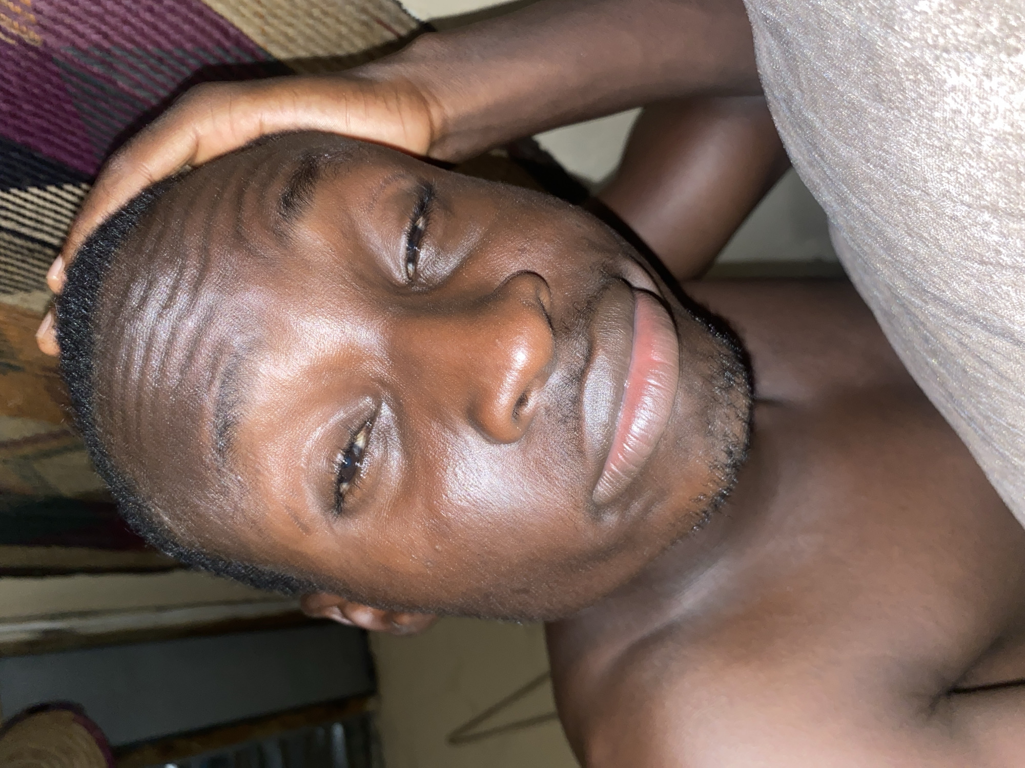 An image, likely taken in Barden Yana, Nigeria, features a man in a close-up, portrait-style shot, oriented diagonally. The man has dark skin, short dark hair, and some facial hair on his chin. He is looking directly at the camera with a neutral to slightly pensive or tired expression, his eyes appearing somewhat heavy-lidded and lips slightly parted. His skin exhibits a shiny or oily texture, reflecting the light.
He appears to be resting or lying down indoors, with one hand visible on his head or forehead. His upper body suggests he might be shirtless or wearing light clothing, as his shoulder and chest area are visible on the right. The background behind him consists of two distinct textures: on the left, a patterned fabric in dark red, black, and possibly brown stripes, resembling a mat or blanket; and on the right, a lighter, solid-colored fabric, possibly another blanket or sheet, with a woven or textured surface. The lighting appears soft and warm, suggesting an indoor setting without strong natural light. There is no visible text in the image.