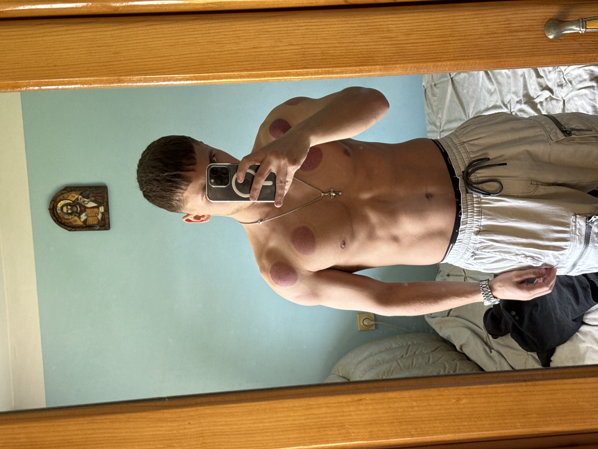 A man is taking a selfie in a mirror. The man has cupping marks on his shoulders and chest. He is wearing light-colored cargo pants and a silver chain with a cross pendant. He is also wearing a watch on his left wrist. The reflection shows a room with light blue walls. There is a small religious icon on the wall. The bed is unmade, with a grey comforter and a black shirt lying on it. The location is unclear, but the assumption is the city of Buhovo, Bulgaria.