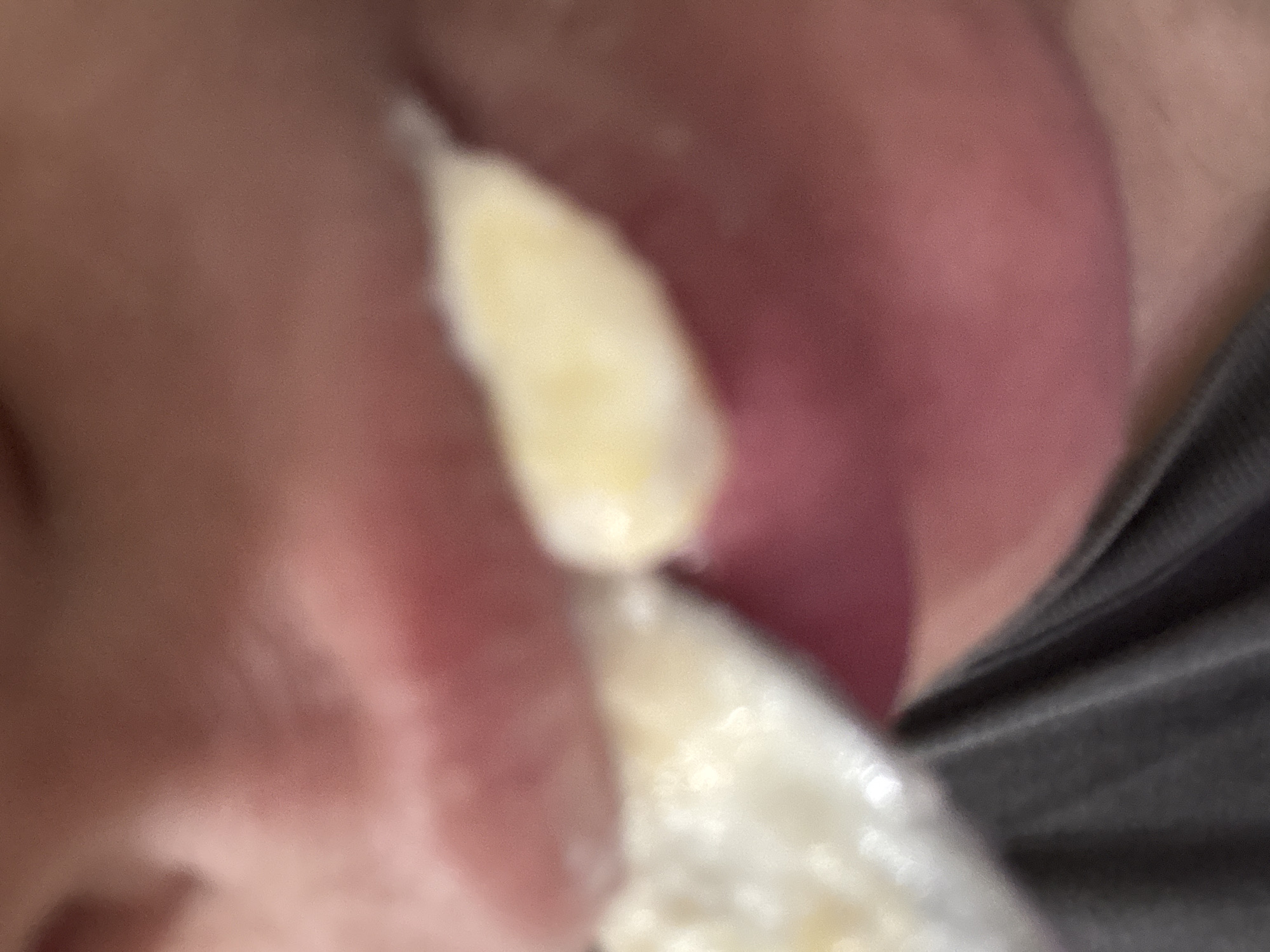 A close-up, blurry image shows a person's mouth with a white substance on their lips. The person is wearing a gray shirt. The background is out of focus and appears to be a person's face. There is no discernible location in Saratov, Russia.
