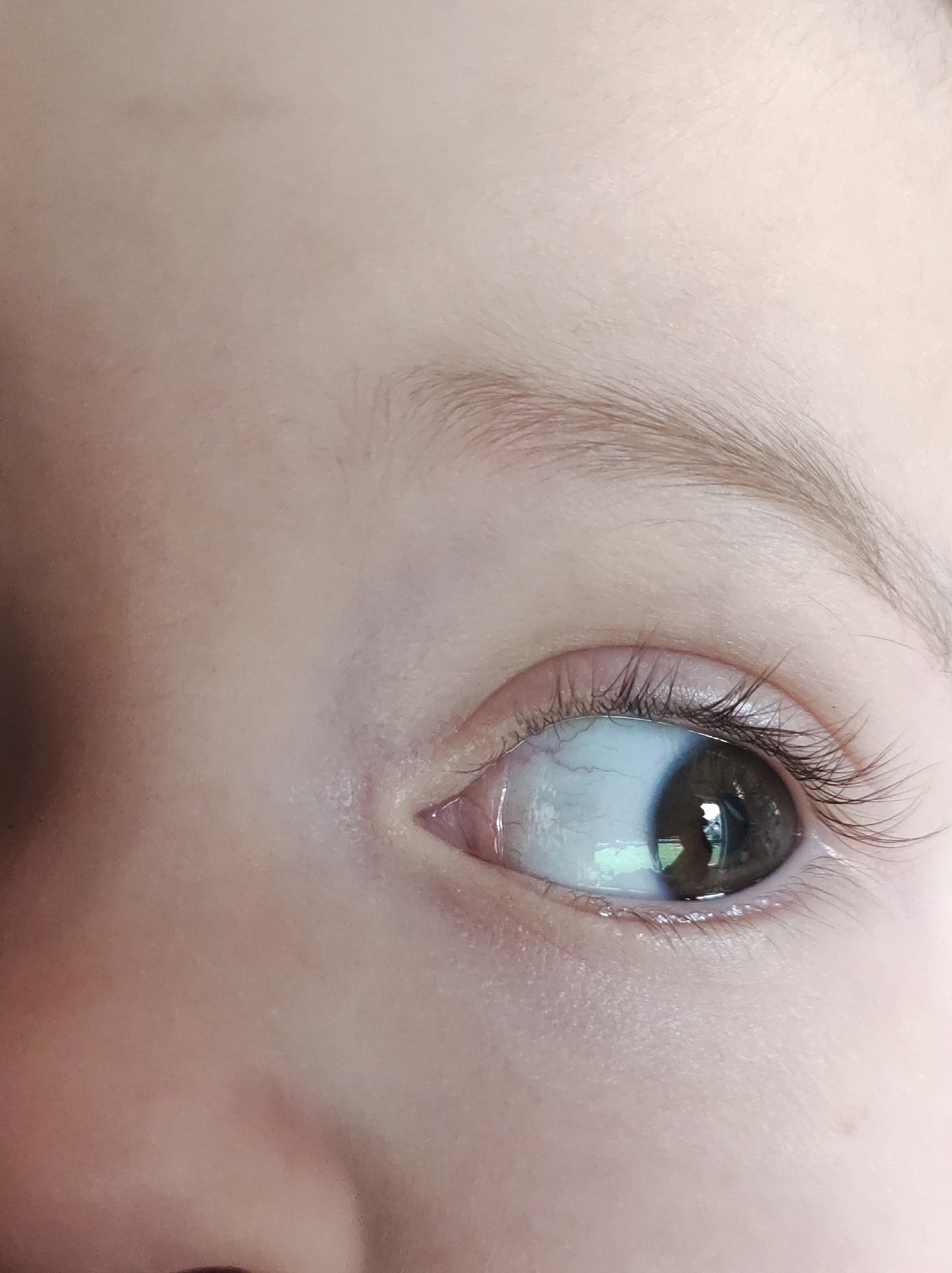A close-up image shows a child's right eye, eyebrow, and surrounding skin. The eye is brown with dark eyelashes. There's a reflection of the surrounding environment in the pupil. The eyebrow is light brown and sparse. The skin appears smooth and lightly colored. There is no evidence to suggest that this image was taken in Фоки, Russia.
