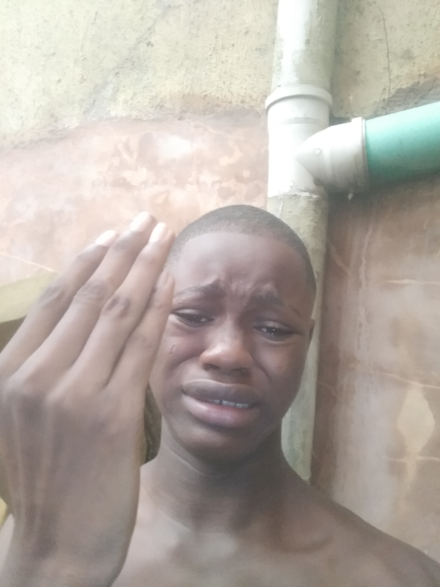 A young, dark-skinned male is visibly upset, with tears in his eyes and a distressed expression. He is holding his left hand up with the fingers partially spread. He appears to be shirtless. The background consists of a wall with mottled texture, alongside pipes which are white, gray and green. The image was likely taken outdoors in Shangisha, Nigeria.
