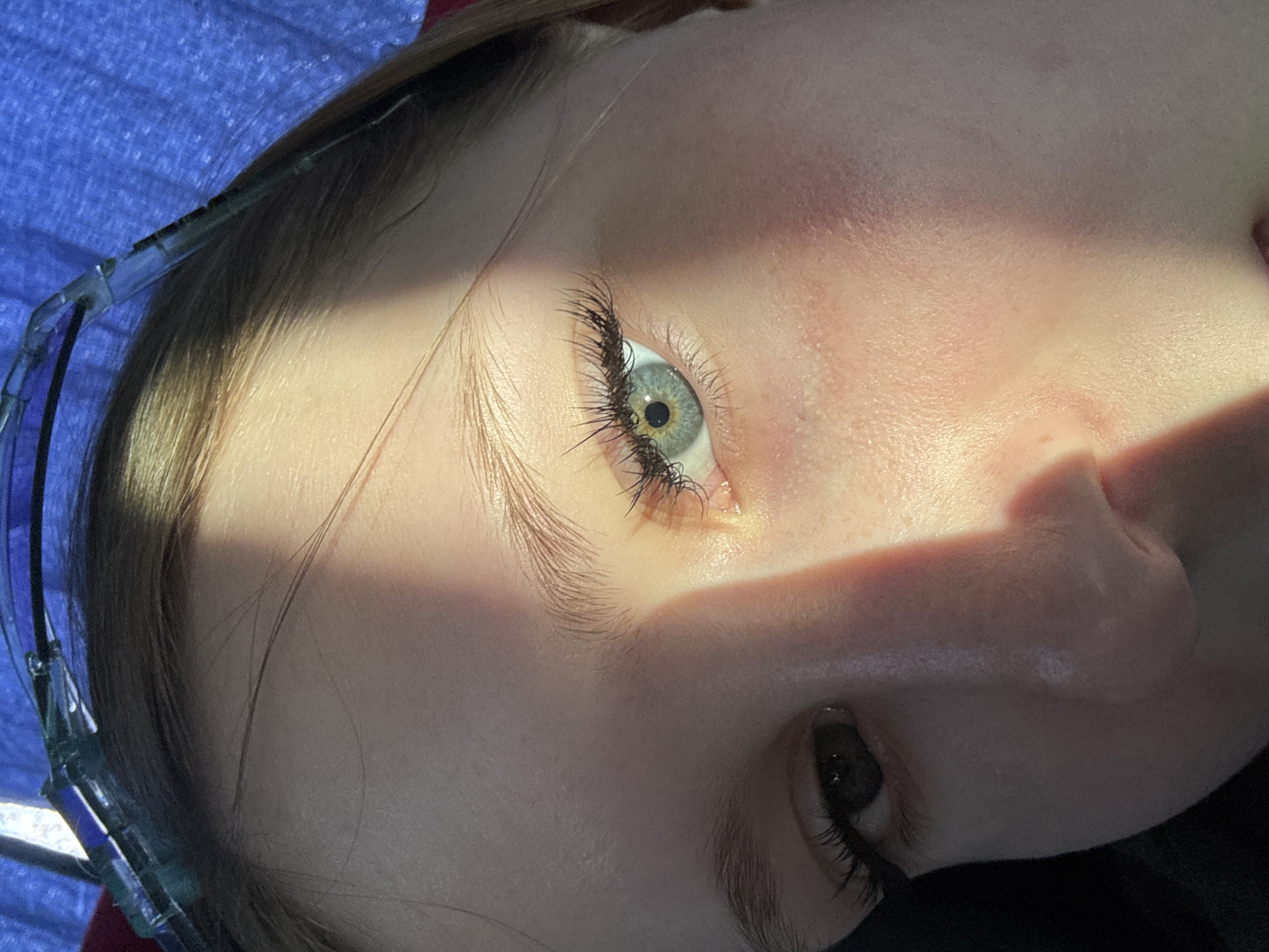 A close-up, tilted view of a person's face shows light blue eyes with long eyelashes. The skin is pale, and light and shadows dramatically highlight facial features. The top eye is fully visible, while the bottom eye is partially obscured. A portion of glasses frames is visible on the left side of the frame. The background is a blurred mix of blue. The location in the city of Berezniki, Russia is undetermined.