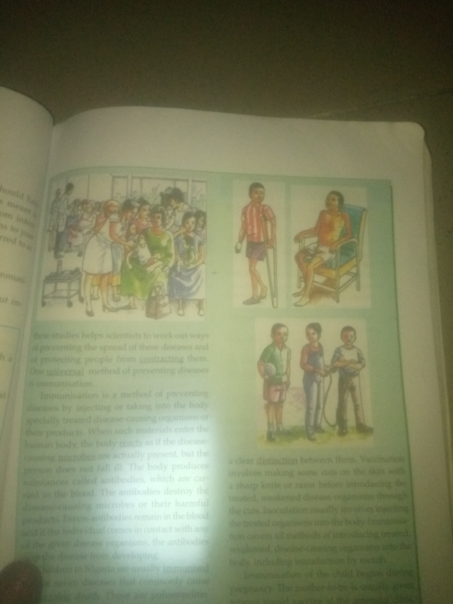 The image displays a page from a book with text and illustrations related to immunization and disease prevention. On the left side of the page, there is an illustration depicting a group of people, possibly in a clinic or public gathering, with some individuals appearing to be receiving medical attention or advice. The text on the left discusses studies aimed at preventing the spread of diseases and protecting people from contracting them, highlighting immunization as a universal method.
The right side of the page features three smaller illustrations. The top-right illustration shows a person using crutches and another person sitting in a chair, both appearing to have mobility issues. The bottom-right illustration displays three children, with one holding a ball and another holding a rope. The text on the right elaborates on the distinction between vaccination and inoculation, describing them as methods of introducing treated, weakened disease organisms into the body to stimulate the production of antibodies. It also mentions that immunization of a child begins during pregnancy and that the mother-to-be is usually given a tetanus vaccine.
The environment appears to be indoors, with the book open on a surface, likely a table. The lighting is somewhat dim, casting a slight glare on the page. No specific city or location can be determined from the image.