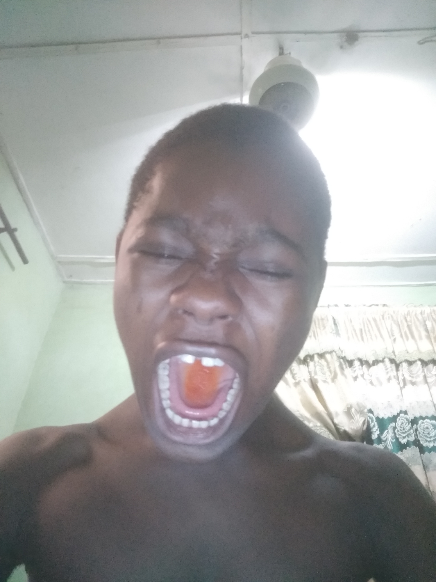 A close-up, low-angle shot depicts a person with dark skin, eyes closed, and mouth open wide, revealing teeth and a reddish object inside the mouth. The person appears shirtless. The background consists of a white ceiling with a light fixture, and a green wall with a curtain. The location and city are unknown.