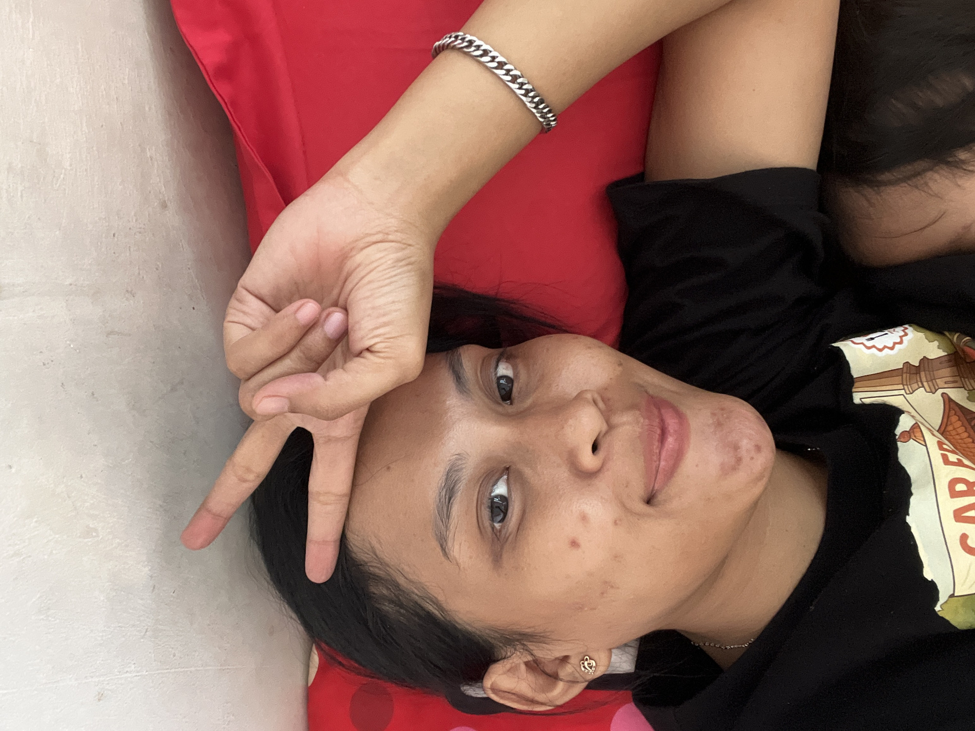 A young woman is lying on a red surface, possibly a bed or couch, in what appears to be an indoor setting. She is looking directly at the camera and has her right hand raised to her forehead, with her index and middle fingers extended in a peace sign. She is wearing a black hoodie and a silver bracelet on her right wrist. Her skin has some blemishes. The background wall is textured and off-white. A small portion of a child's head and hair is visible in the lower right corner of the image, suggesting the presence of another person. The overall scene appears to be a casual, personal moment captured in a photograph, likely in a residential area within Kecamatan Pati, Indonesia.