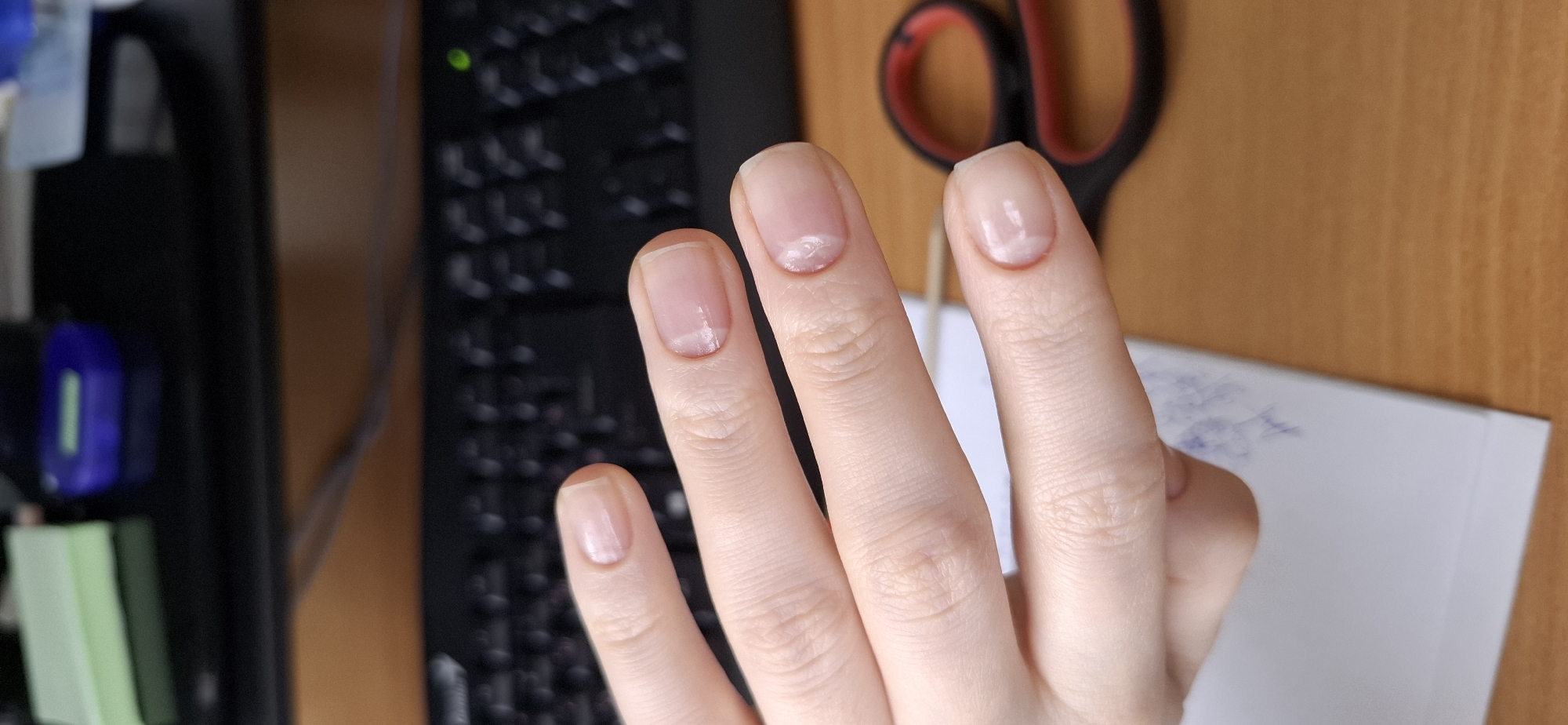 A close-up, eye-level shot captures a person's left hand and fingers, displaying the nails against a blurred indoor background. The hand, likely female, is fair-skinned, with four fingers distinctly visible. The nails appear natural, without polish, and several show prominent white, cloudy patches, possibly indicative of leukonychia or minor damage. The middle finger and index finger prominently display these white marks near the nail tips.
The background suggests a desk or workspace setting. To the left, a dark computer keyboard with partially visible keys and a single illuminated green light is present. Further to the left, blurred objects include what appears to be a blue USB device with a green indicator light and some light green, rectangular items, possibly binders or books. To the right of the hand, a pair of red and black handled scissors is partially visible, and beneath it, a white piece of paper with faint, indistinct blue markings or writing. The overall lighting is bright and even, typical of an indoor environment during daytime. No specific text is legible in the image, and no emotions are discernible.