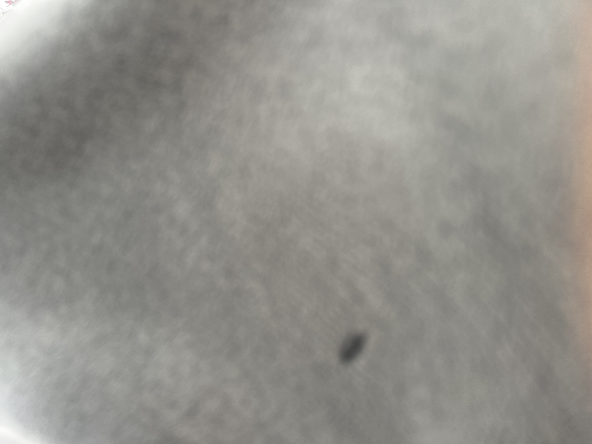 The image is a close-up, out-of-focus shot of a textured, gray surface, likely fabric or a similar material. A small, dark, oval-shaped mark is visible in the lower left quadrant of the image. The lighting appears to be diffuse. No people, specific objects, or environmental context related to the city of Shumen, Bulgaria are discernible in this image.