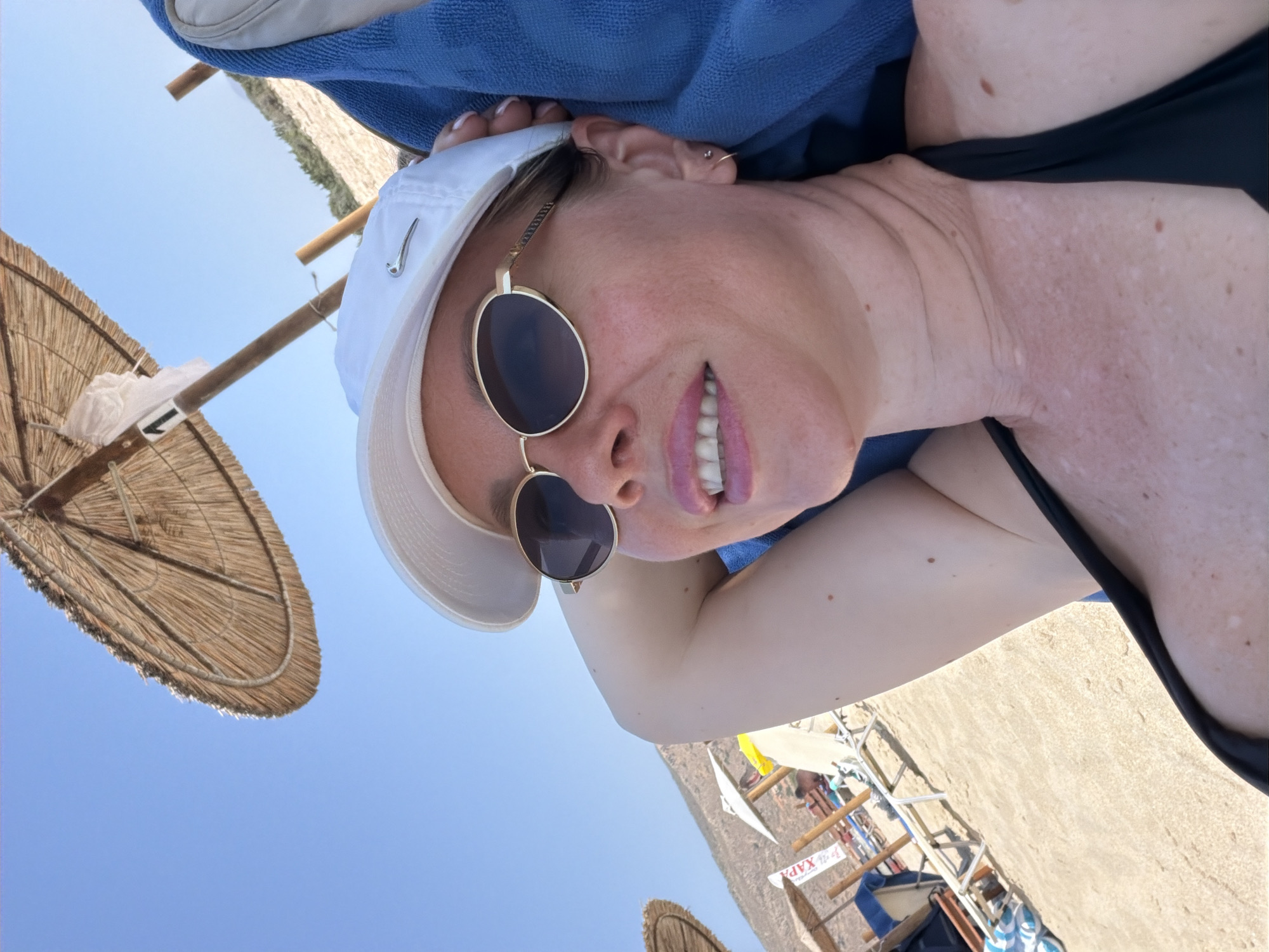 The image shows a woman wearing a white baseball cap and sunglasses, with a blue towel around her. She is lying down on a beach, with straw umbrellas and lounge chairs visible in the background. The sky is clear and blue, suggesting it is daytime and sunny. The woman is smiling and looking at the camera. Her skin appears tanned, and there are some mole and vitiligo marks visible. The overall scene depicts a relaxed vacation or beach outing. There is some text visible on a sign in the background, but it is too blurry to read clearly. The location is unknown, but the prompt suggests it is Greece.