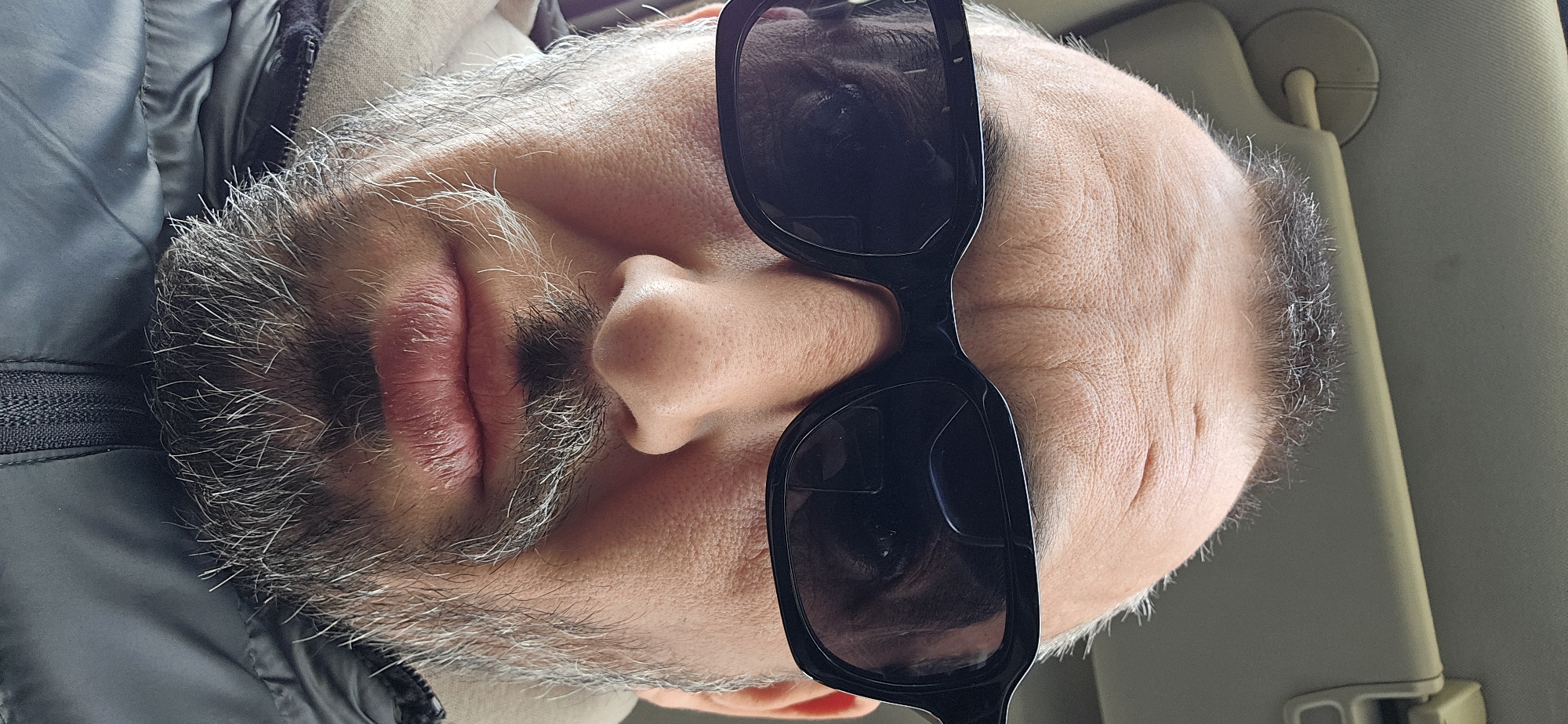 A close-up portrait captures a man with his head tilted significantly to the left within the frame, showing him from a slightly upward angle. He wears dark, square-framed sunglasses, which obscure his eyes. His face is characterized by a full beard and mustache, heavily streaked with grey and white hairs, giving him a salt-and-pepper appearance. His lips are slightly parted, revealing a neutral expression.
He is dressed in a dark-colored jacket, possibly a padded or puffer style, with a visible zipper detail on the left side of the image. The skin on his face shows visible pores and some fine lines, particularly on his forehead and the area around his right temple.
The setting appears to be the interior of a vehicle, suggested by a light-colored sun visor visible behind his head on the right side of the image. The natural light indicates it is daytime, consistent with the use of sunglasses. There is no specific activity depicted beyond the man being present in the car. No text is visible in the image. The photo is contextually located in Norwich, United Kingdom.