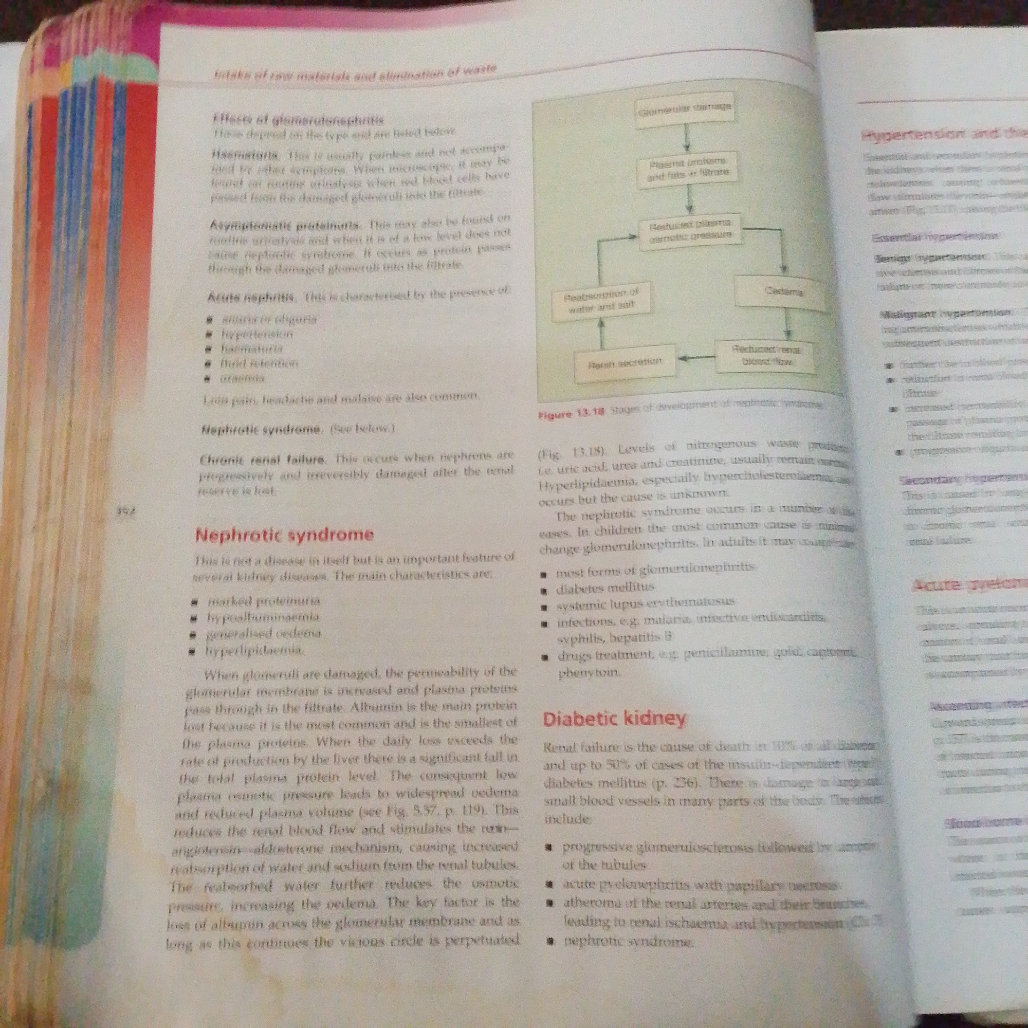 The image shows a section of a textbook, likely on human anatomy or physiology, with text and diagrams related to kidney diseases. The pages are open, revealing a table of contents or index on the left side with a margin featuring colorful book edges. The main content discusses conditions like "Effects of glomerulonephritis," "Acute nephritis," "Nephrotic syndrome," and "Diabetic kidney." A flow chart illustrating the "Stages of development of nephrotic syndrome" is also visible. The text is in English and appears to be informational, explaining symptoms, causes, and consequences of these medical conditions. There are no elements in the image that suggest a specific location in Jalingo, Nigeria, or any forensic details.