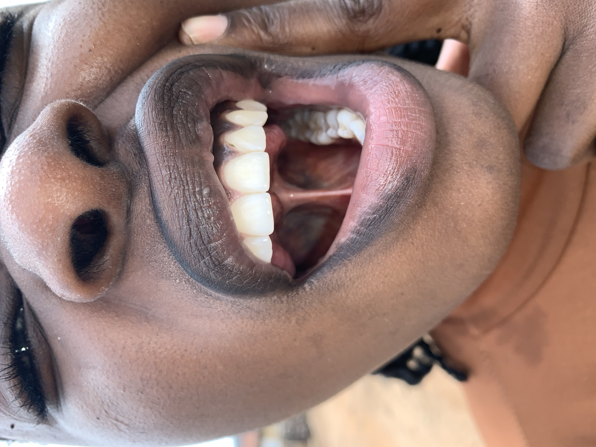 A close-up, angled portrait features an individual with dark brown skin, focused on their open mouth. The person's mouth is stretched wide, prominently displaying bright white upper incisors and canines, along with the internal oral cavity including the uvula, soft palate, and tonsillar pillars. The lips are full and darkly pigmented, possibly enhanced by dark cosmetic application, while the skin around the mouth shows natural pores. The subject's partially visible right eye appears squinted, and the right hand is seen pulling at the corner of the mouth to maintain the wide opening. A rust-colored garment is visible on the lower left portion of the frame, covering the shoulder and upper chest. The background is heavily blurred into soft tones of light brown and tan, suggesting an outdoor, earthy, or sandy environment. The scene is located in Rafin Par, Nigeria.