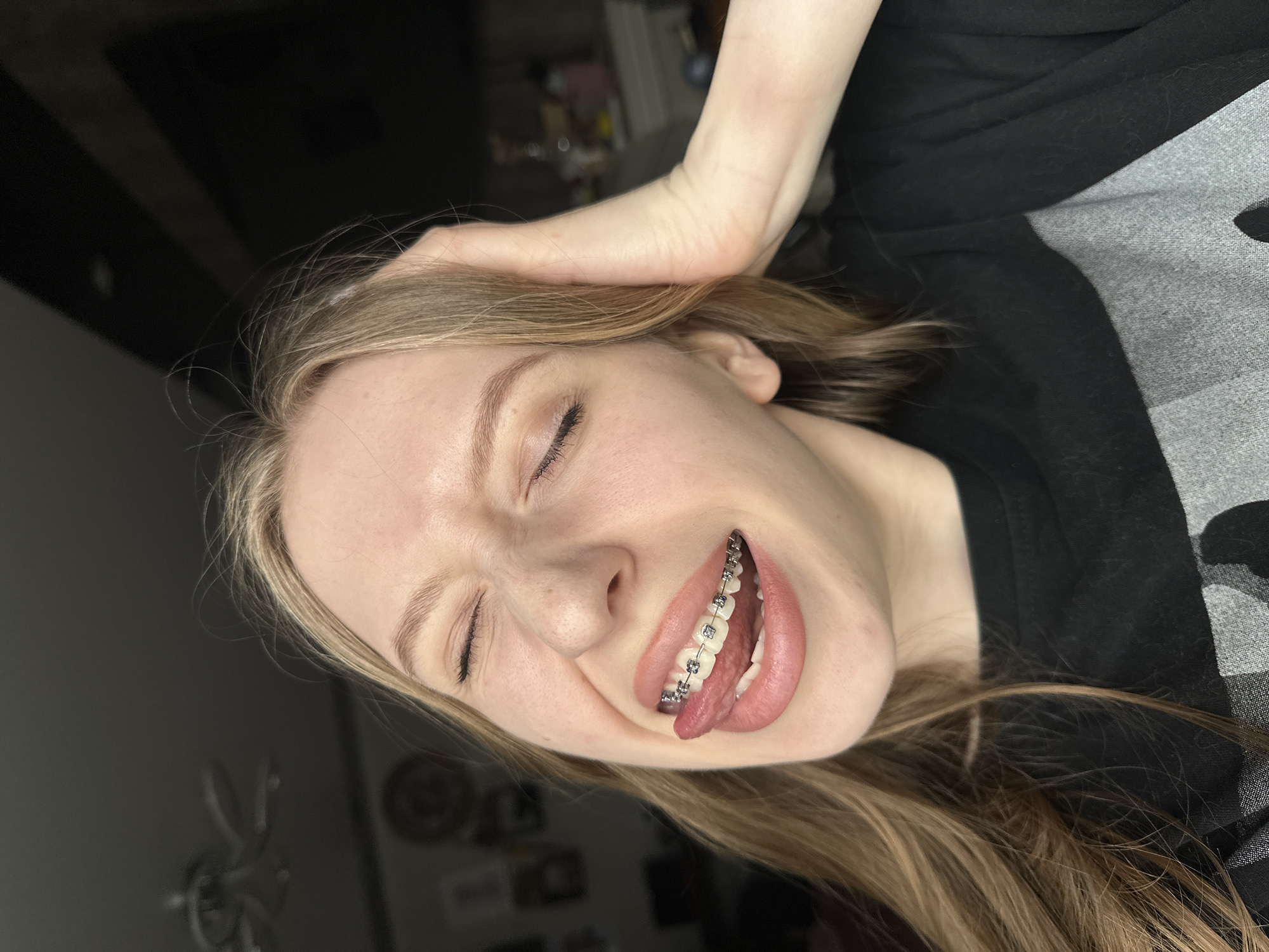 A young woman with fair skin and light brown hair is positioned at an oblique angle, her eyes closed and her tongue sticking out to the side, revealing braces on her teeth. Her left hand rests on her head. She wears a black shirt with a gray patterned overlay. The background is dimly lit, showing a wall and glimpses of objects behind her, suggesting an indoor environment. There is no indication of this image being taken in the city of Chaikovsky, Russia.