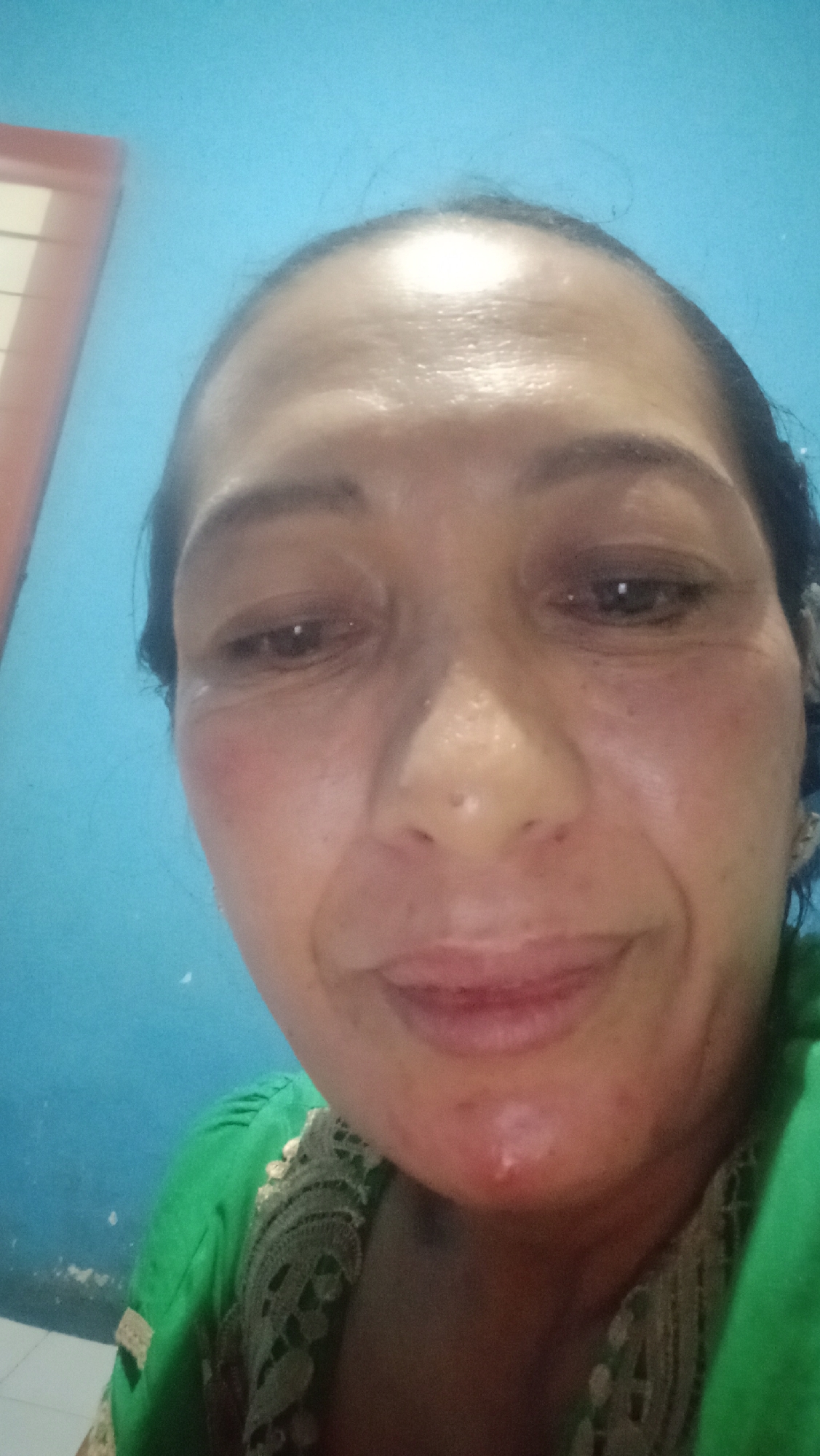 This is a close-up, eye-level, selfie photograph of a woman from Denpasar, Indonesia. The woman has medium-toned skin, dark hair, and is looking directly at the camera. Her face appears shiny, and she has a small blemish or cut on her chin. She is wearing a green top with lace trim. The background consists of a light blue wall, and a portion of a window frame can be seen in the upper left corner. The lighting suggests artificial indoor lighting.