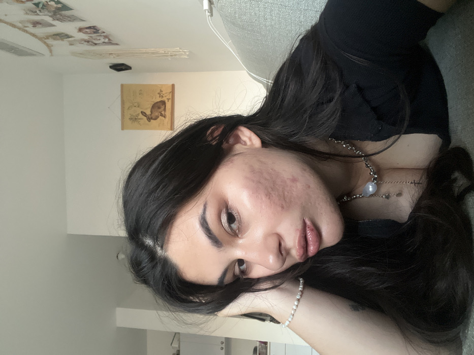 The image captures a female individual from the chest up, positioned in a domestic indoor setting within Kiryat Bialik, Israel. She is reclining on a light-colored, ribbed upholstered surface, likely a sofa. The individual has long, dark hair parted centrally, framing her face. Her left cheek (viewer's right) displays prominent skin texture consistent with acne scarring. She wears a black, low-cut top, a white pearl bracelet on her left wrist, and a metallic necklace adorned with an irregular white pearl pendant and multiple small charms, including a small cross. Her left hand is raised, resting near her temple. The background consists of light-colored walls; to the left, white kitchen-style cabinetry is visible. To the right, wall decorations include a vintage-style botanical print depicting a rabbit, a small dark framed item, and a macrame wall hanging strung with multiple small photographs or cards. The ceiling is white.