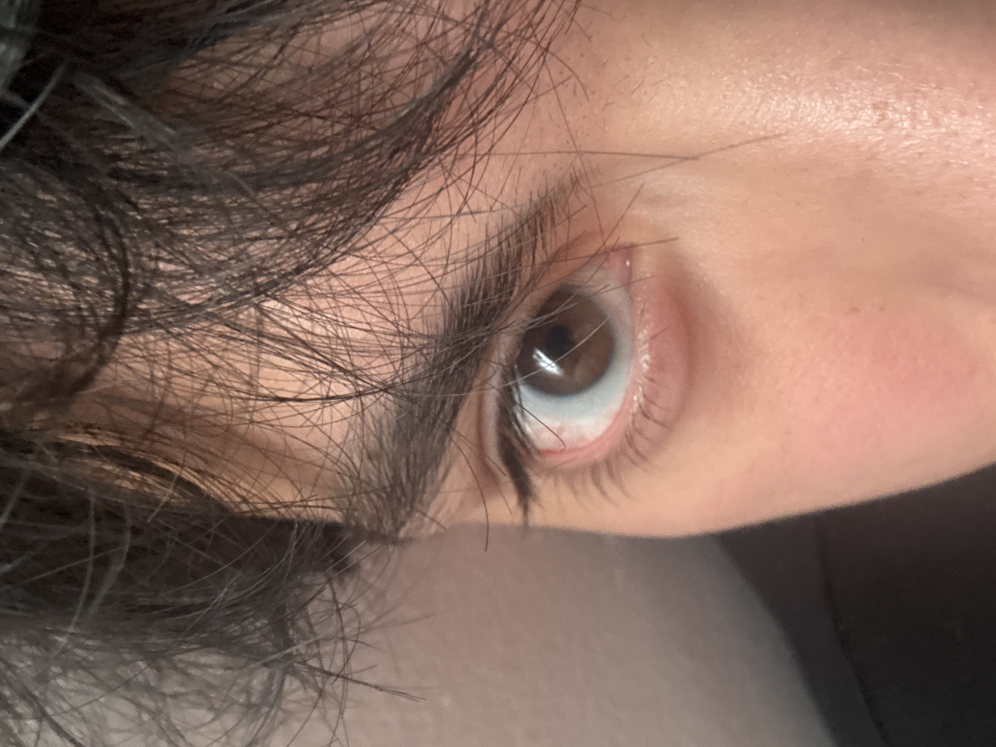 A close-up photograph shows a human eye with brown iris, surrounded by skin and dark hair. The eye is open, and the gaze is directed upward. The skin tone appears fair. The hair is dark and slightly disheveled. No information suggests the location is Mexico City.