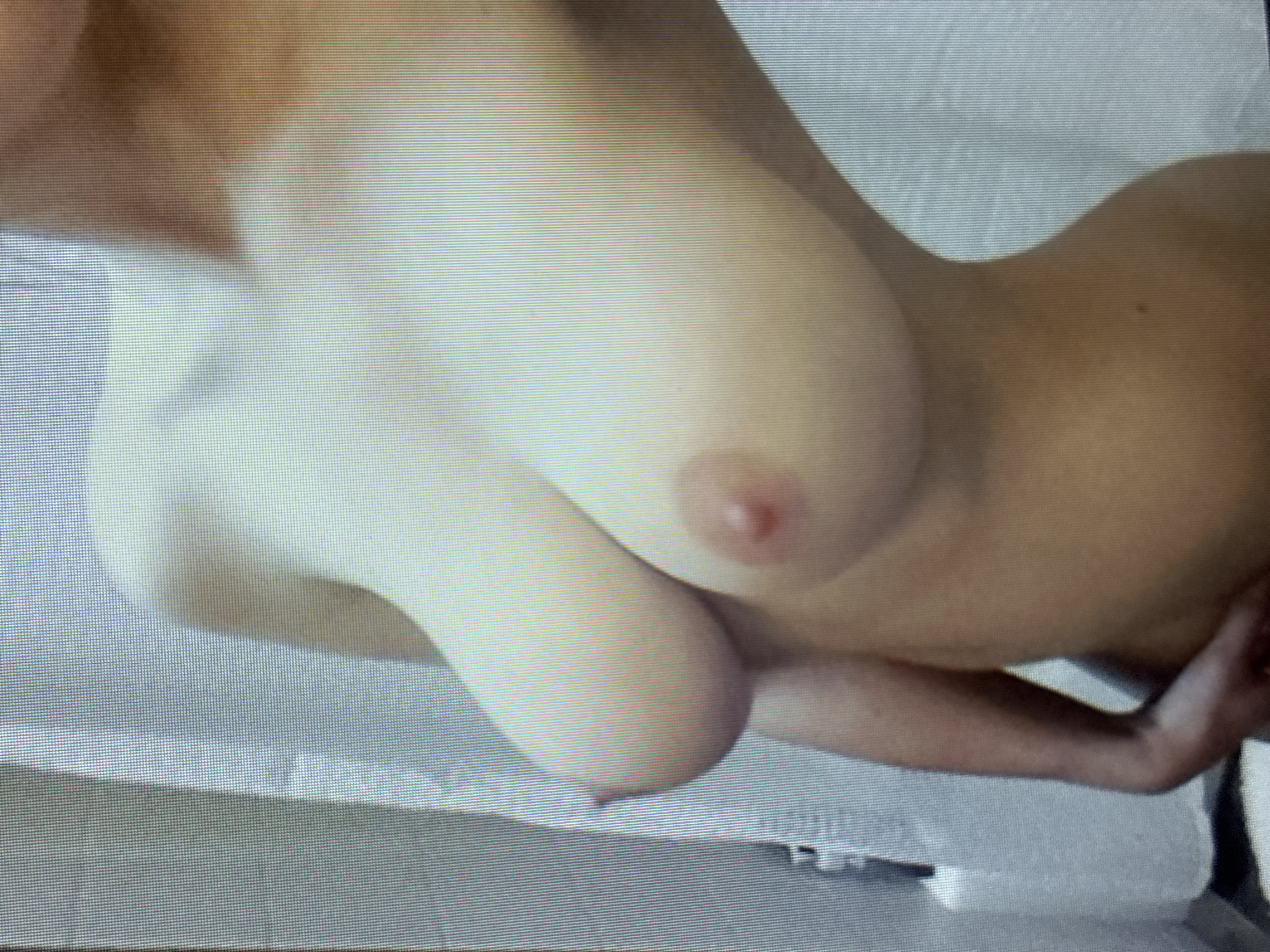 The image captures a close-up, high-angle view of a person's upper torso, focusing on the chest area. The individual, who appears to be female, is nude or partially nude and is lying down on a light-colored surface, possibly a bed or a studio setup covered with a sheet or fabric.
Two breasts are prominently featured in the foreground. Both nipples are visible and appear engorged. The skin tone ranges from fair to light brown. A portion of an arm, with a slightly darker skin tone, is visible in the lower right quadrant of the frame, seemingly resting or supporting the body. The background is a soft, light, textured material, consistent with bedding or a light fabric.
A distinctive feature of the image is the presence of horizontal scan lines across the entire frame, indicating that this is likely a photograph taken of a digital screen or monitor. The lighting is soft and appears to be even, without harsh shadows. No specific time of day, weather conditions, explicit emotional cues, or text are discernible within the image. The crops provided confirm these details, offering closer views of the skin, breasts, and the pervasive scan lines.
