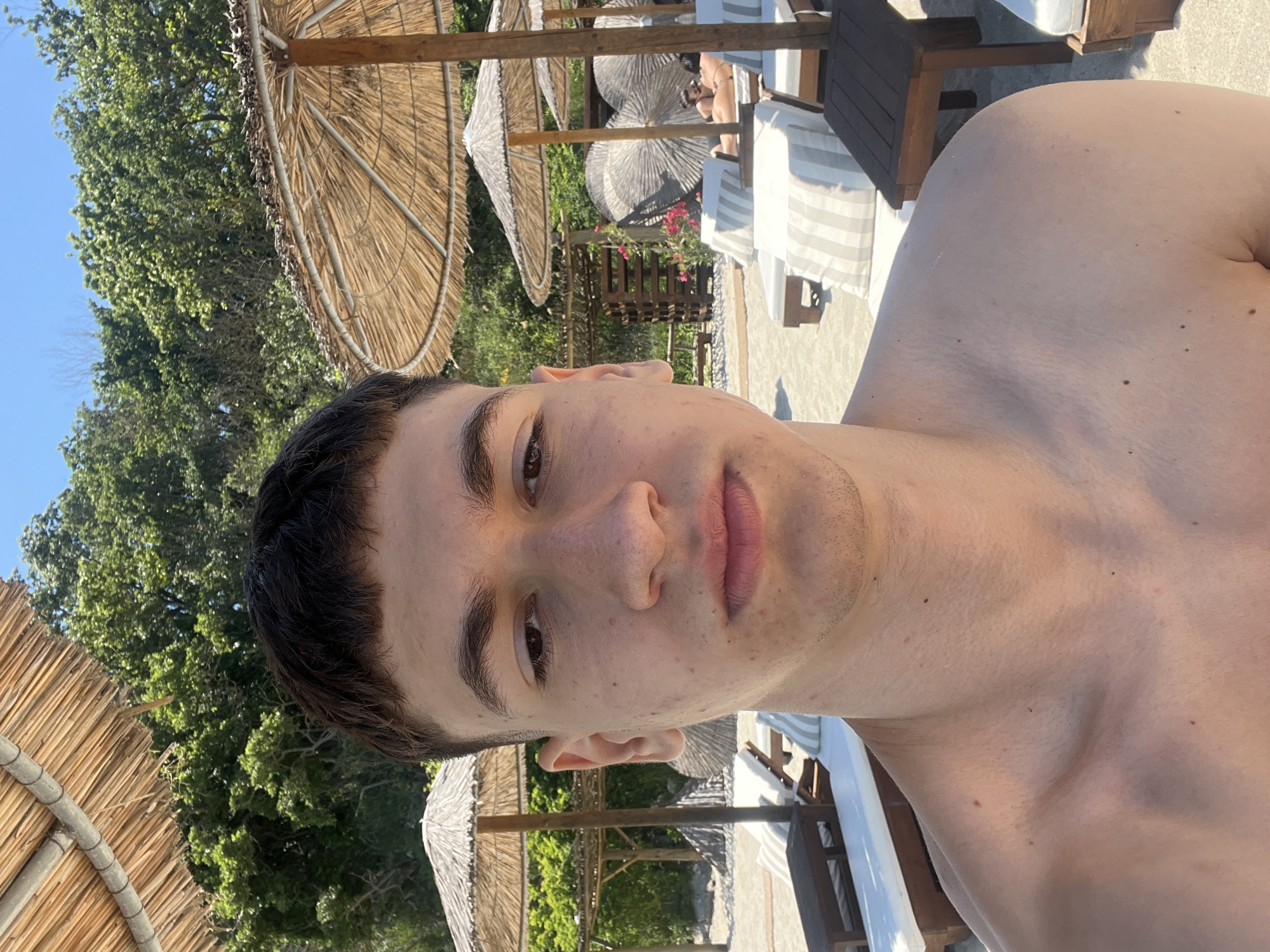 A young man with short, dark hair and fair skin is taking a selfie at the beach. He is shirtless and appears to be in his late teens or early twenties. The background shows a sunny beach scene with several lounge chairs and straw umbrellas. In the distance, two people are lying on lounge chairs, and lush green trees line the back of the beach. The location is likely Sunny Beach in Varna, Bulgaria, given the characteristic beach setup and the presence of straw umbrellas.