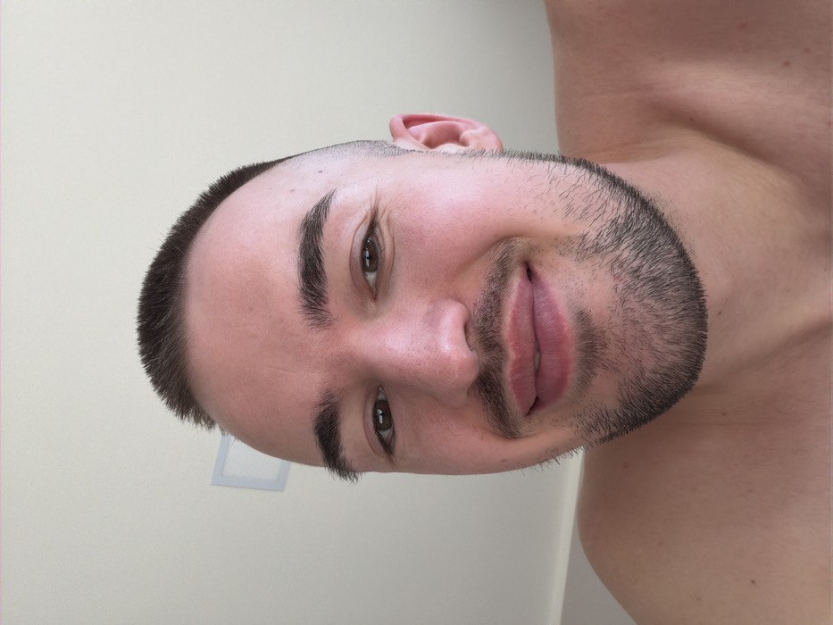A close-up selfie depicts a male subject indoors in Kladnitsa, Bulgaria. The subject, a young adult male, occupies the majority of the frame, smiling faintly with his lips slightly parted. He has short, dark brown hair styled in a buzz cut with faded sides, dark brown eyes looking directly at the viewer, and dark, defined eyebrows. A short, well-trimmed dark stubble beard is present on his chin and jawline. His skin appears fair with some visible pores and slight redness on the cheeks. His bare shoulders and upper chest are visible. The background consists of a plain, light-colored ceiling or wall, with a partial view of a recessed, square light fixture visible in the upper left quadrant. No other subjects, objects, or specific actions beyond posing for the photograph are discernible.