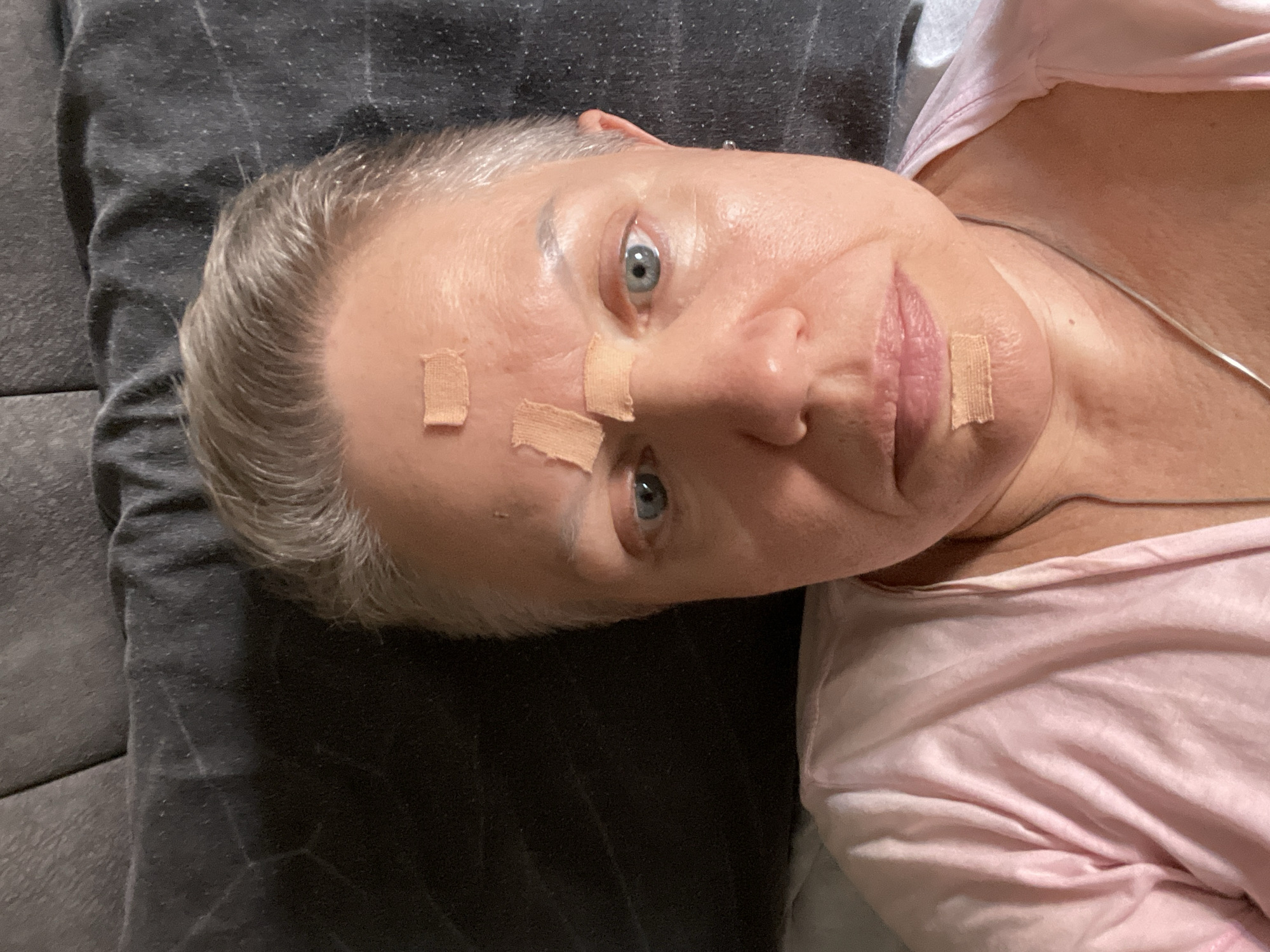 A woman with short, light-colored hair is lying down, looking at the camera. She is wearing a pink shirt. There are several small bandages on her forehead and chin. The background is a dark, textured surface, possibly a couch. The lighting is soft and natural. The image appears to be a selfie. There is no information to suggest this image is located in Kadıköy, Turkey.