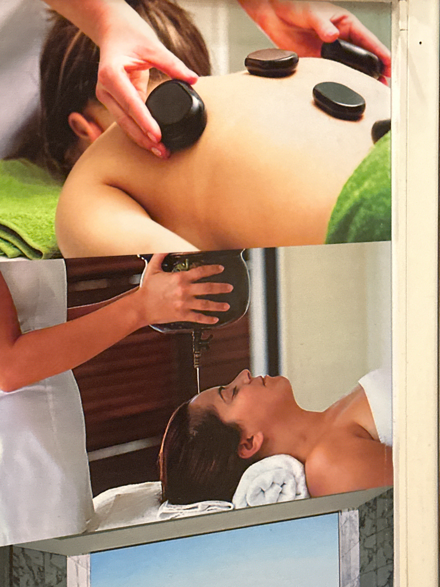 The image is a collage of two separate photographs. The top photograph shows a person lying face down, receiving a hot stone massage on their back. Several dark, smooth stones are placed on the person's back, and a hand is visible placing another stone. A green towel is visible on the left side of the frame. The bottom photograph shows a person lying on their side, receiving a treatment that involves a dark vessel being held over their head, with liquid or steam emanating from it. A white towel is rolled up and placed under the person's head. The environment appears to be a spa or wellness center. There is no information provided about the location in Kathmandu Metropolitan City, Nepal.