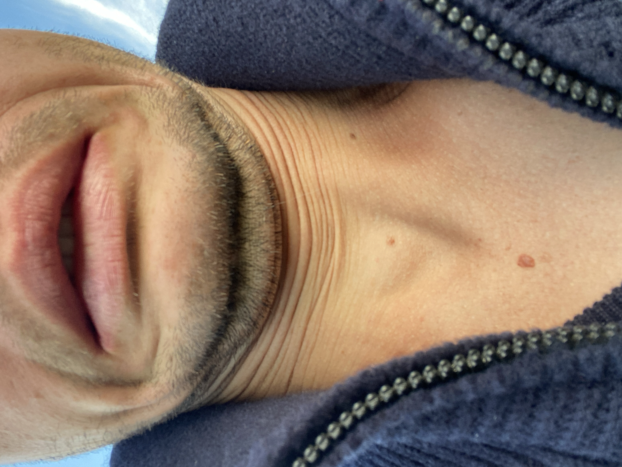 The image shows a close-up of a person's mouth, chin, and neck, wearing a dark blue zippered garment. The person has stubble on their chin and neck. The skin on the neck is wrinkled. There are two moles visible on the neck. The background shows a blurred blue sky with some wispy white clouds. The image is taken from a low angle, looking upwards. No specific location in Oktyabr'skii, Russia is identifiable from the image.