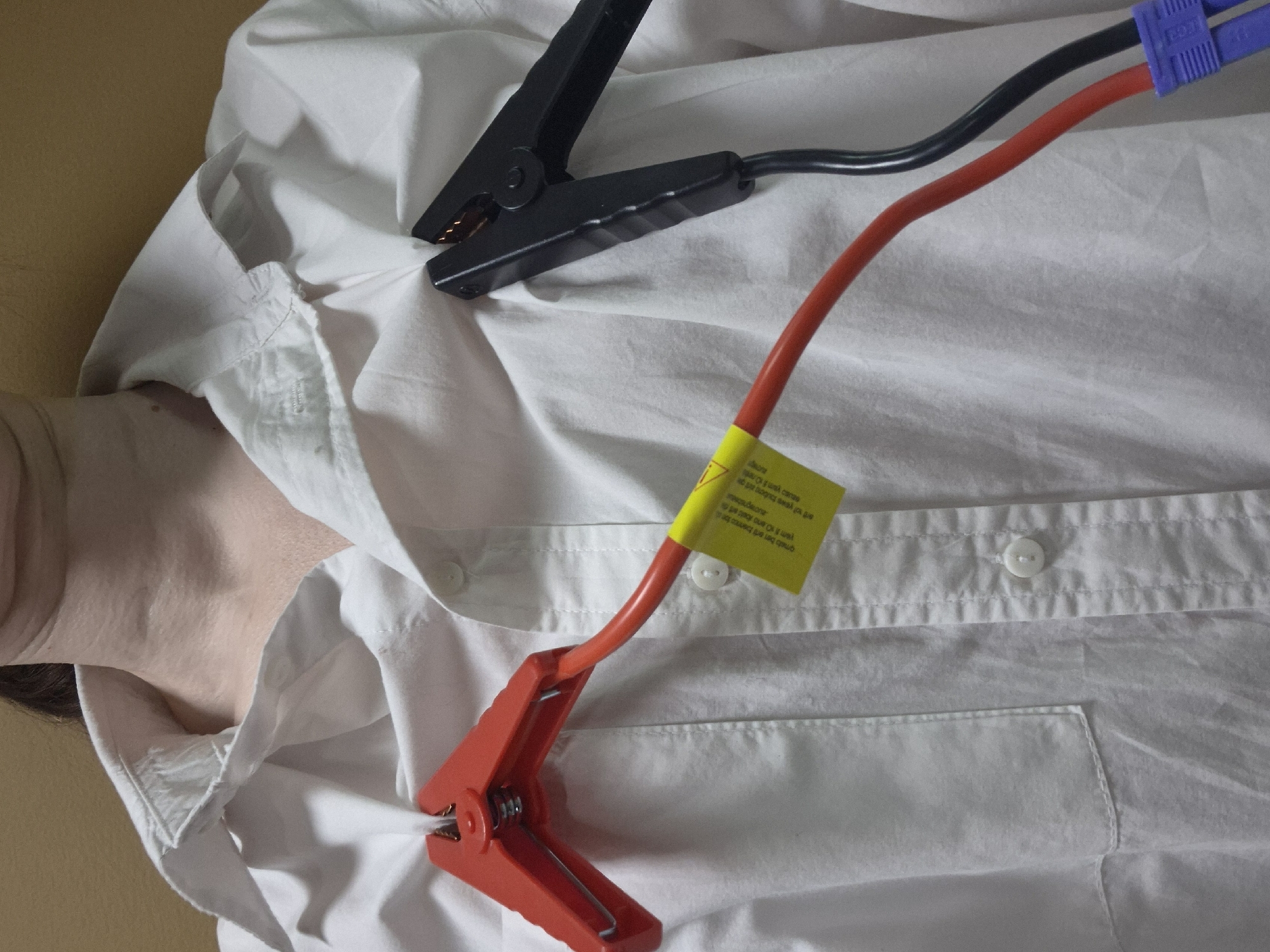 A pale-skinned individual wearing a white button-down shirt is lying on a surface with a light-brown background. Red and black jumper cables are clipped to the shirt; the red clamp is attached near the collar, and the black clamp is near the shoulder. A yellow label is affixed to the red cable. The scene's location is Unknown, Unknown.