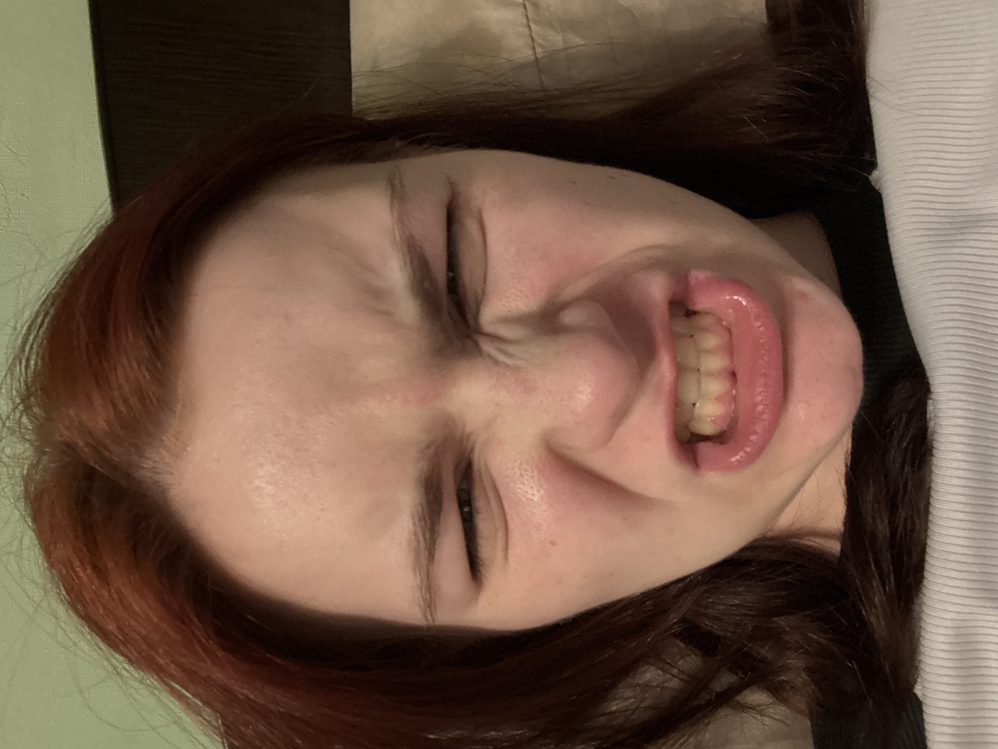 The image shows a close-up of a young person's face, with their eyes scrunched shut and their teeth bared in a grimace. Their mouth is open, revealing their teeth and gums. The person has red hair and fair skin. The background is blurred and appears to be indoors, possibly a bedroom, with a textured wall and a pillow visible. There are no clear indications of the city of Sinyavino, Russia, or any other specific location. The image focuses solely on the person's facial expression.