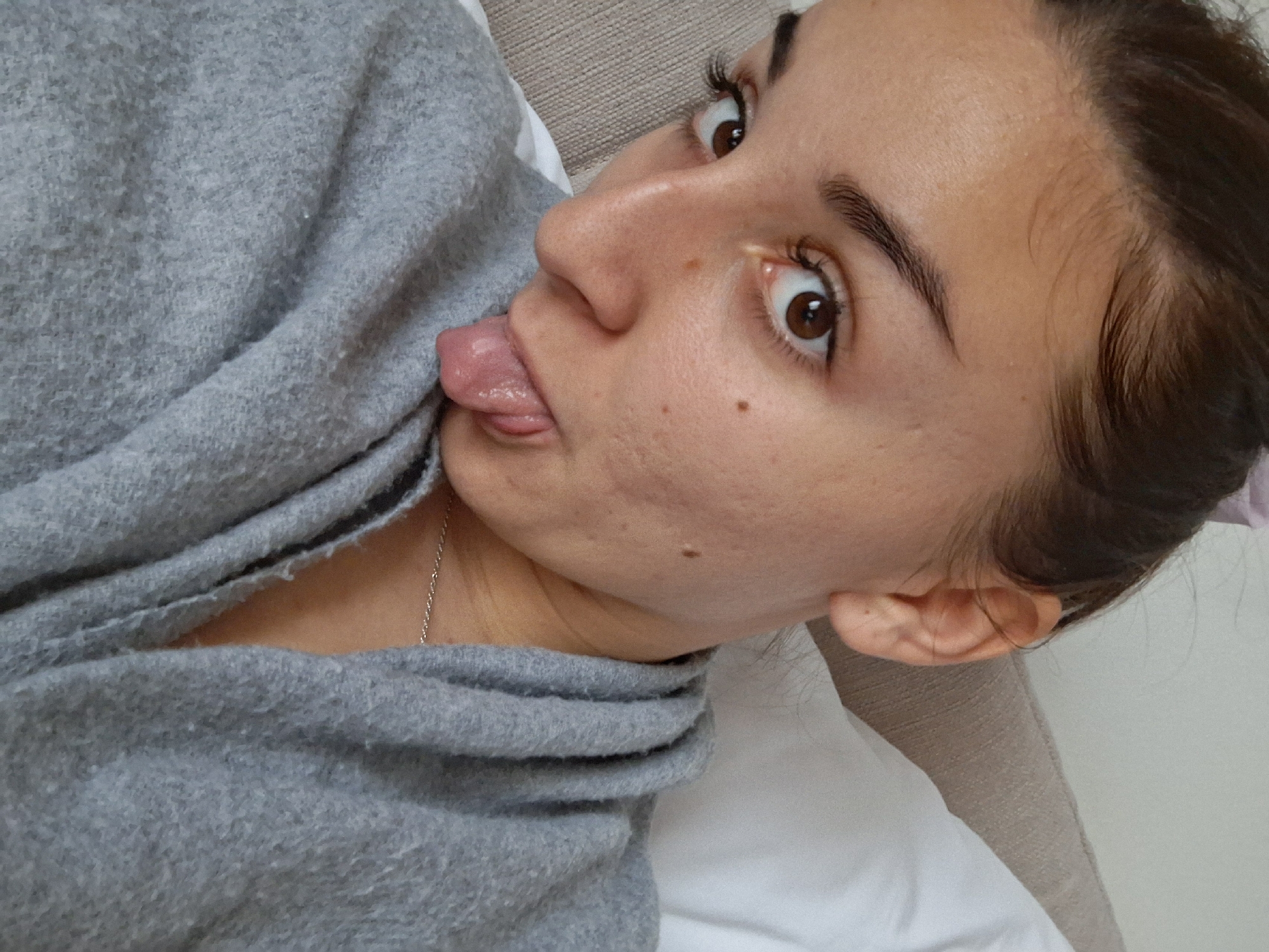 The image displays a close-up, eye-level shot of a single individual, identified as likely an adult female, situated indoors within the city of Vozdovac Urban Municipality, Serbia. The subject has medium-brown hair styled away from the face, with some finer strands visible at the hairline. Her brown eyes are open wide and directed toward the viewer. The face exhibits fair skin tone with several distinct moles, including one prominent dark mole positioned inferior to the right eye (viewer's left) and multiple smaller moles/blemishes on the right cheek. The individual is captured in the act of extending her tongue downwards and slightly to the right, indicating a playful or informal expression. She is wearing a light grey, textured garment, possibly a sweater, robe, or blanket, which covers her shoulders and chest. A thin, silver-colored chain necklace is visible around her neck. The background consists of a light-colored (likely white) pillow or cushion positioned behind the subject's right side, and a beige or light brown upholstered surface, consistent with a sofa or bed headboard, visible behind the left side and extending to the top right of the frame.