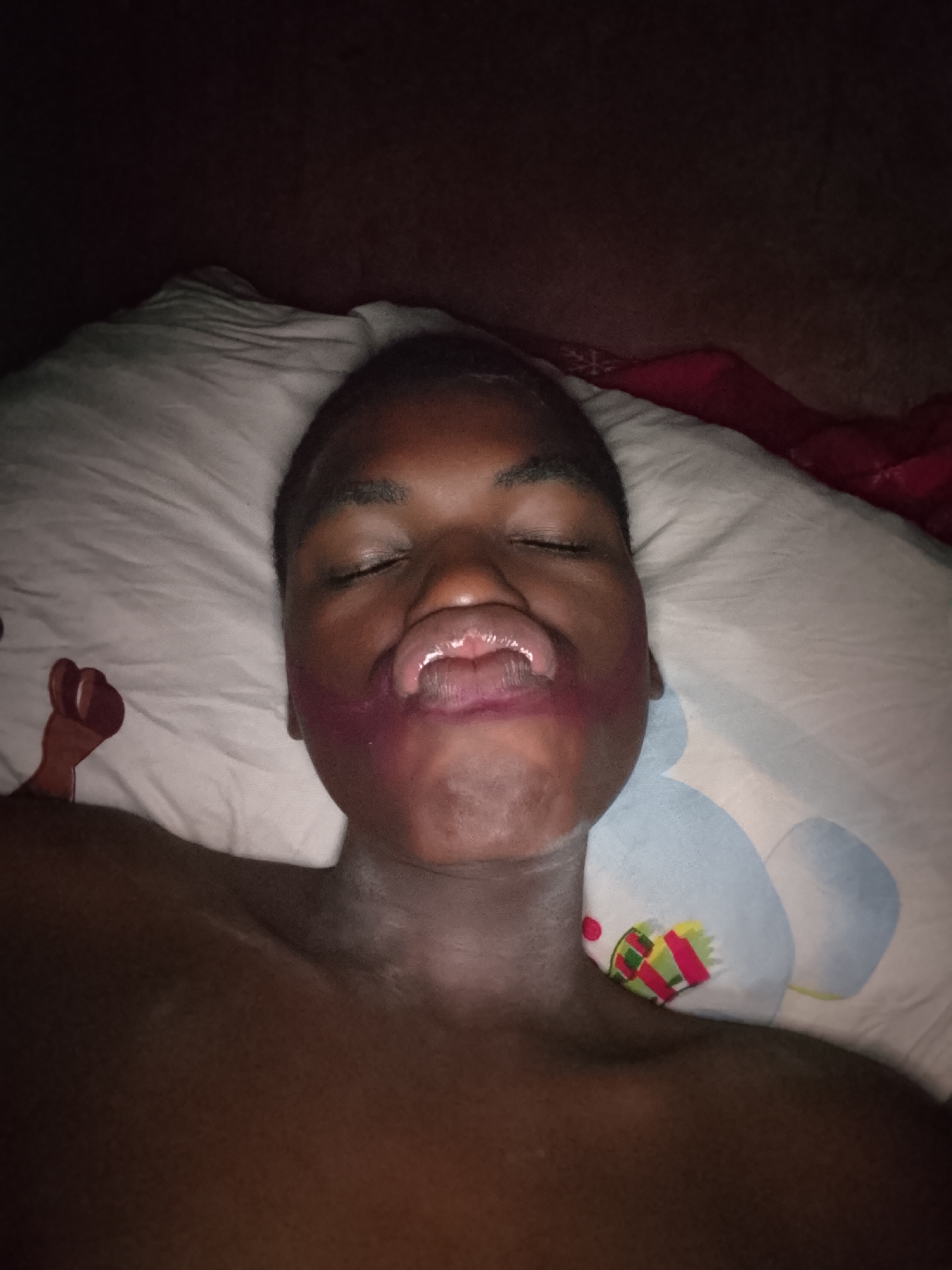 The image displays a person, likely a young individual with dark skin, lying down on a bed or similar surface, appearing to be asleep or resting. Their eyes are closed, and their mouth is slightly open, revealing some teeth. A prominent reddish-purple mark or stain is visible around their mouth and chin, suggesting a smudged substance such as food, drink, or makeup. This mark has also transferred onto the white pillow beneath their head, near their right cheek.
The person is centrally framed, lying on a white pillow with subtle patterns. On the right side of the pillow, a light blue design resembling a cartoonish character is visible. On the left side, a brown, fist-like or hand-shaped graphic is present. A red blanket or sheet can be seen in the background on the right side of the image, behind the pillow.
The scene is dimly lit, suggesting the photo was taken in low-light conditions, possibly at night or in a poorly lit room. The overall atmosphere conveys a sense of stillness and rest. There is no visible text in the image. The location context provided is Nkpor, Nigeria, though no specific visual cues within the image confirm this.