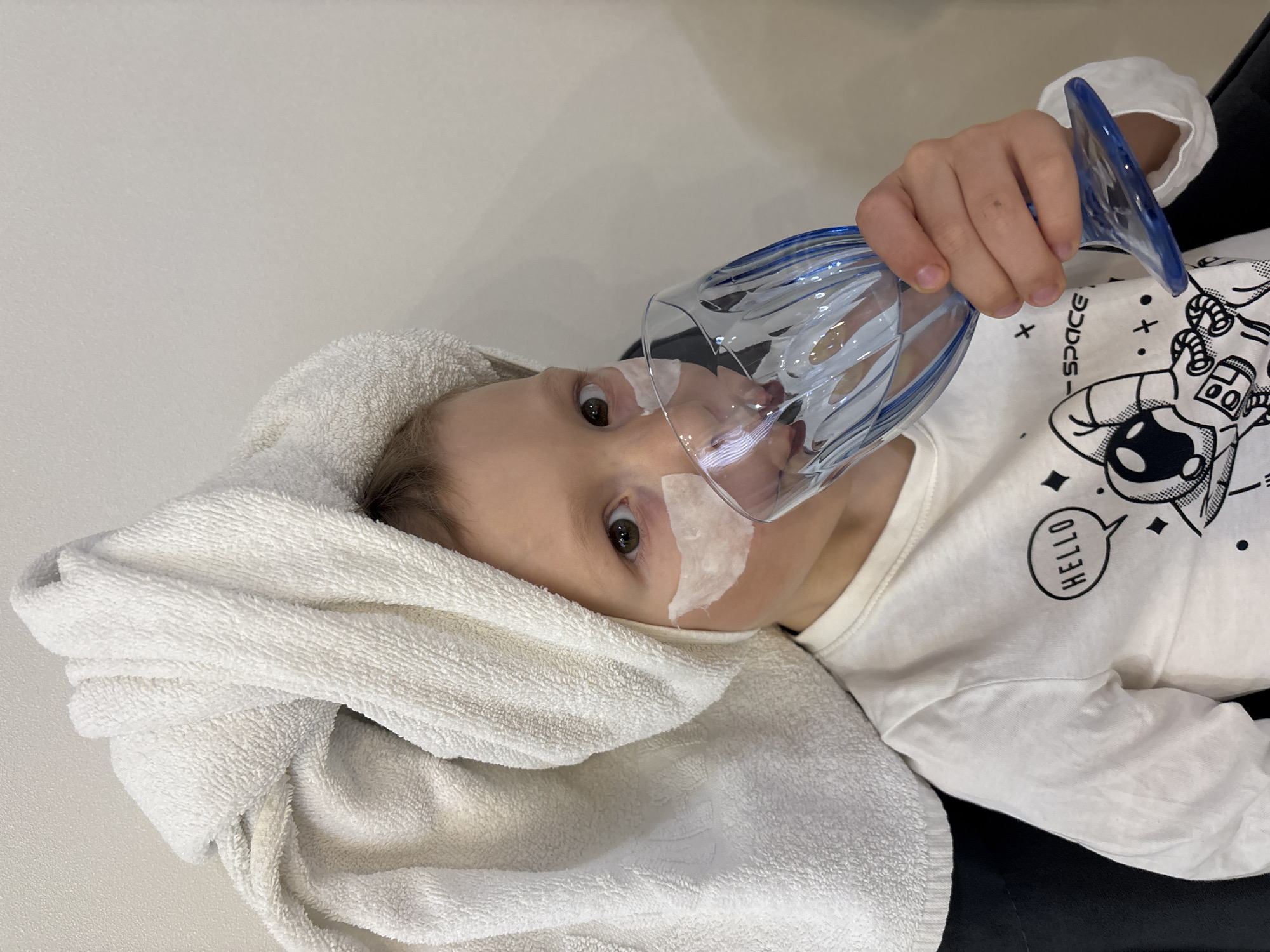 A child lies on their back with a white towel draped around their head, wearing a long-sleeved white shirt with an astronaut and the word "HELLO" printed on it. The child is holding a blue and clear glass over their face, with white tape visible around the glass where it meets the skin. The background appears to be a plain white wall. The location is Chaikovsky, Russia.