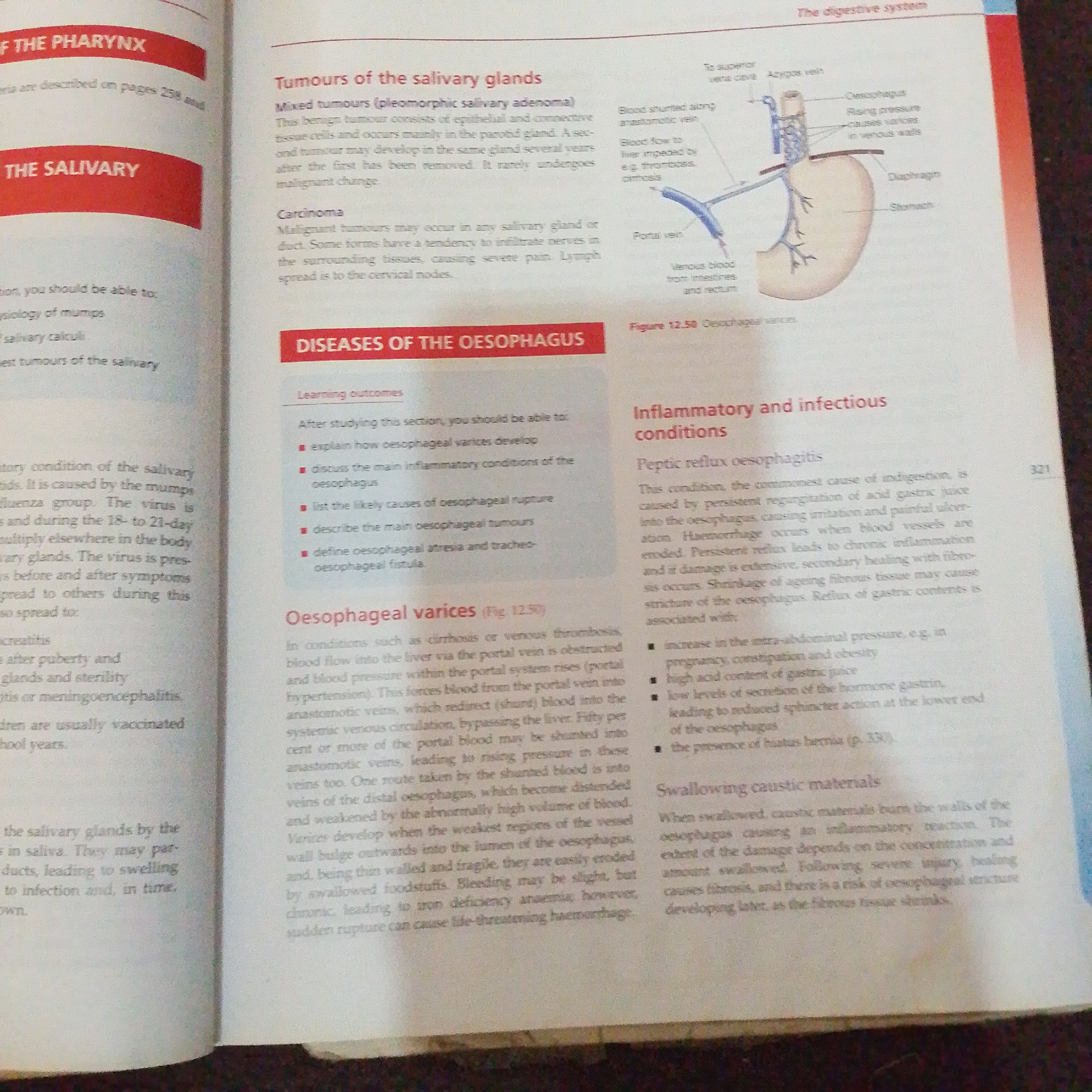 The image is a photograph of an open book. The book is in English and appears to be a medical textbook, likely on anatomy or physiology. The left page has headings "OF THE PHARYNX" and "THE SALIVARY". It also contains bullet points related to the salivary glands, including "physiology of mumps" and "salivary calculi". The right page has headings "Tumours of the salivary glands", "Carcinoma", "DISEASES OF THE OESOPHAGUS", and "Inflammatory and infectious conditions". There is a diagram labeled "Figure 12.50 Oesophageal varices" showing blood flow related to the esophagus. The text discusses various medical conditions and treatments. There is no information in the image that relates to Jalingo, Nigeria, or any city.