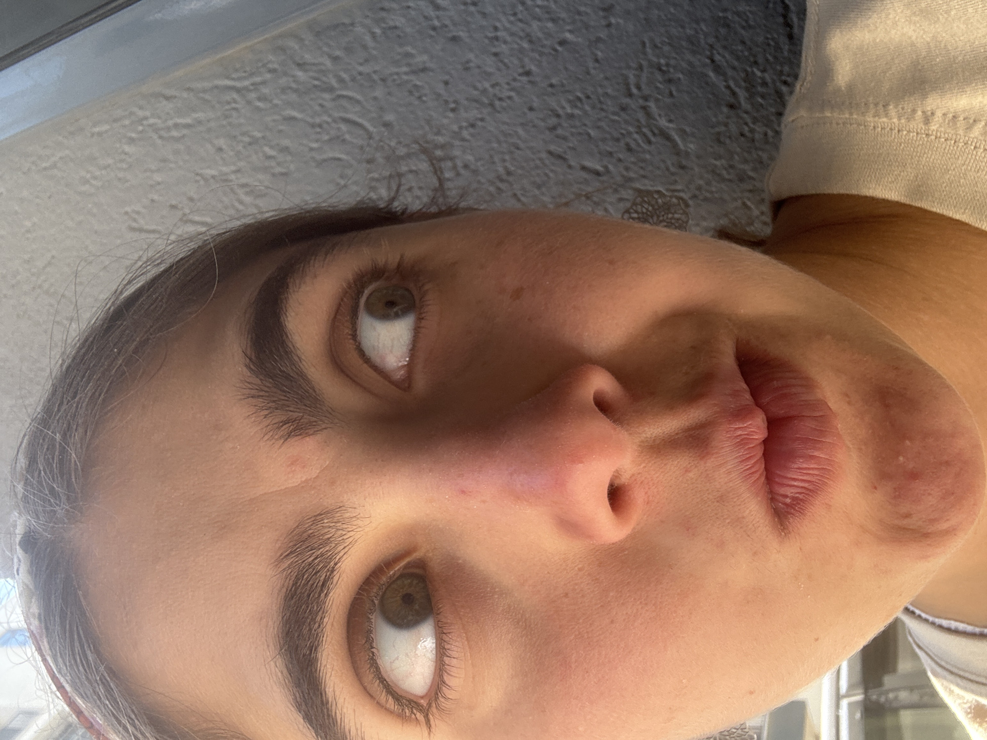 A close-up, portrait-style photograph captures a person's face, vertically oriented and tilted slightly to the right. The subject has fair skin, expressive green or hazel eyes that are gazing upwards and to the right. Their dark, well-defined eyebrows frame the eyes. The mouth is slightly pursed, forming a subtle "fish face" or pout, suggesting a playful or contemplative expression. Dark hair is visible around the face, with some lighter, possibly graying, strands at the temples. The skin exhibits a few minor blemishes, including some redness around the nose and chin, and scattered freckles. The person is wearing a light-colored, possibly white or off-white, t-shirt, visible on the right side of the frame. The background is softly blurred, showing a textured, light-colored wall or ceiling, with a darker, undefined edge at the top. The scene is illuminated by bright, natural light, indicating it is daytime. No text is visible in the image.